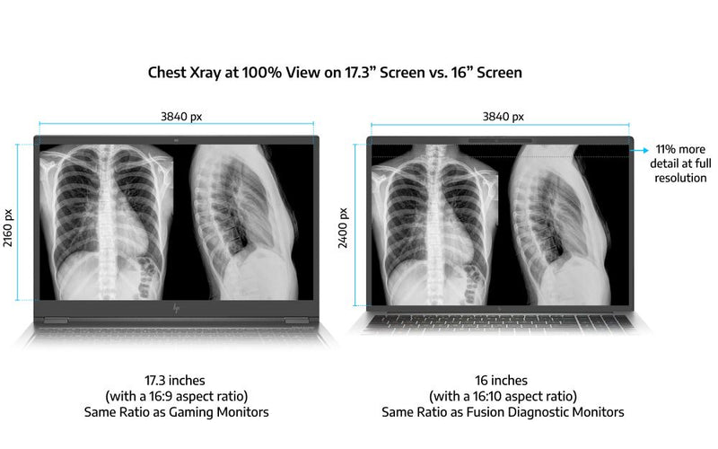 Why 16-Inch Displays with a Taller Aspect Ratio are Better for Radiologists than Traditional 17.3-Inch Screens