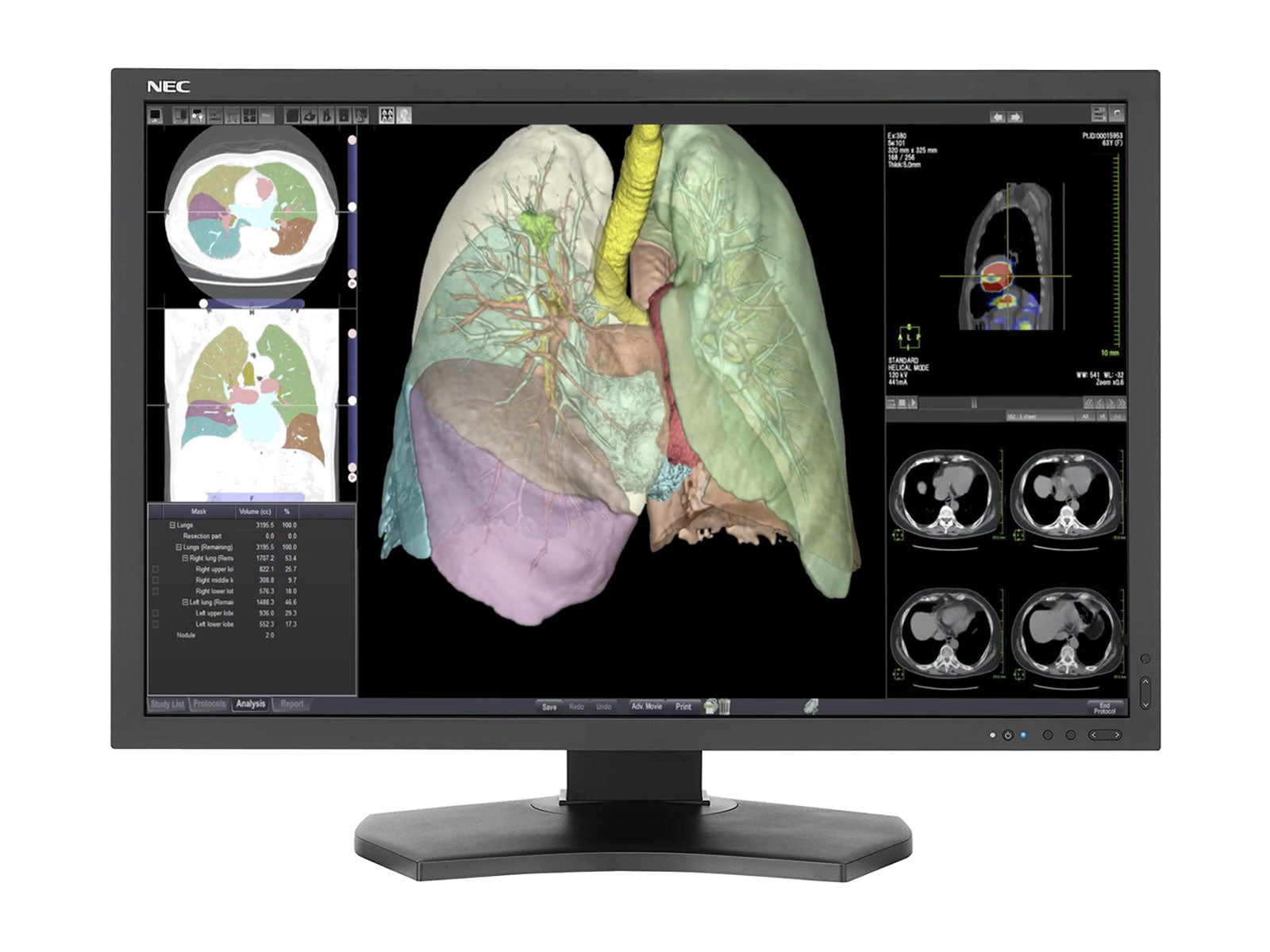 NEC MultiSync MD301C4 4MP 30" General Radiology PACS Display (MD301C4) Monitors.com 