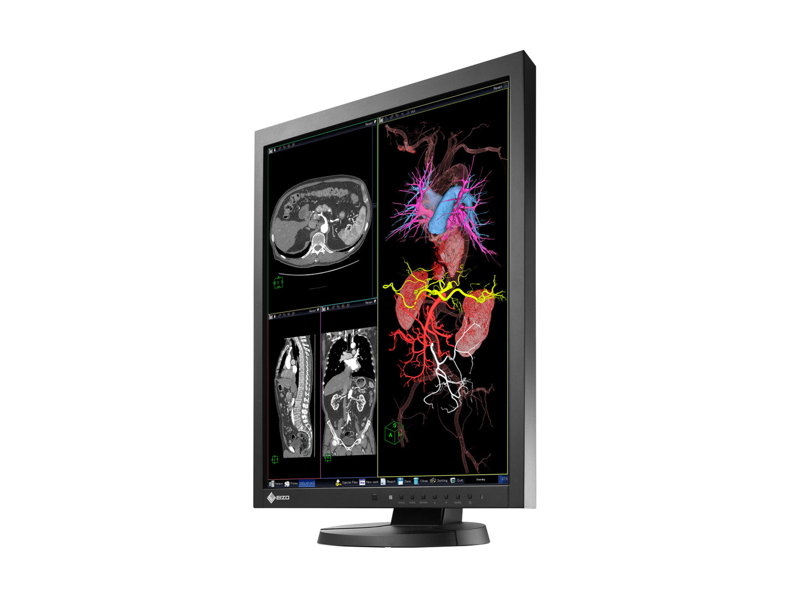 Eizo RadiForce MX215 2MP 21" Clinical Review Display (MX215-BK)