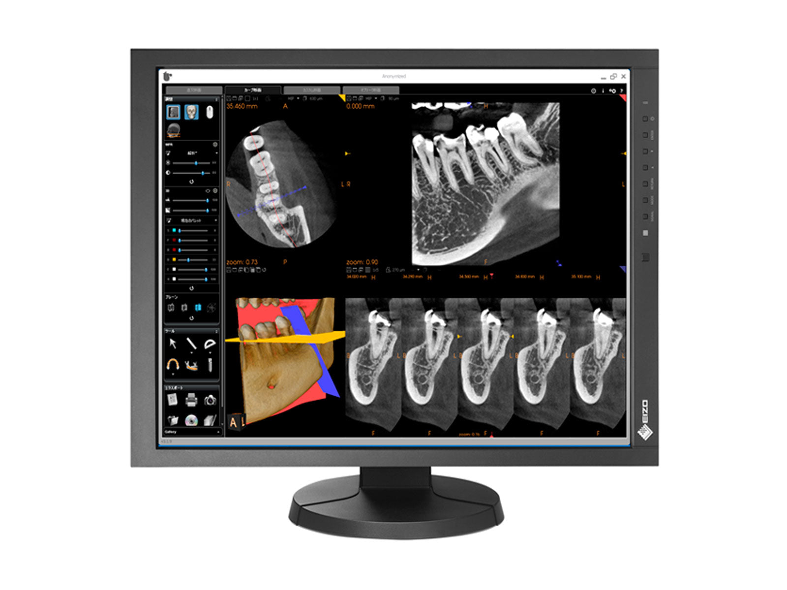 Eizo RadiForce MX215 2MP 21" Clinical Review Display (MX215-BK)