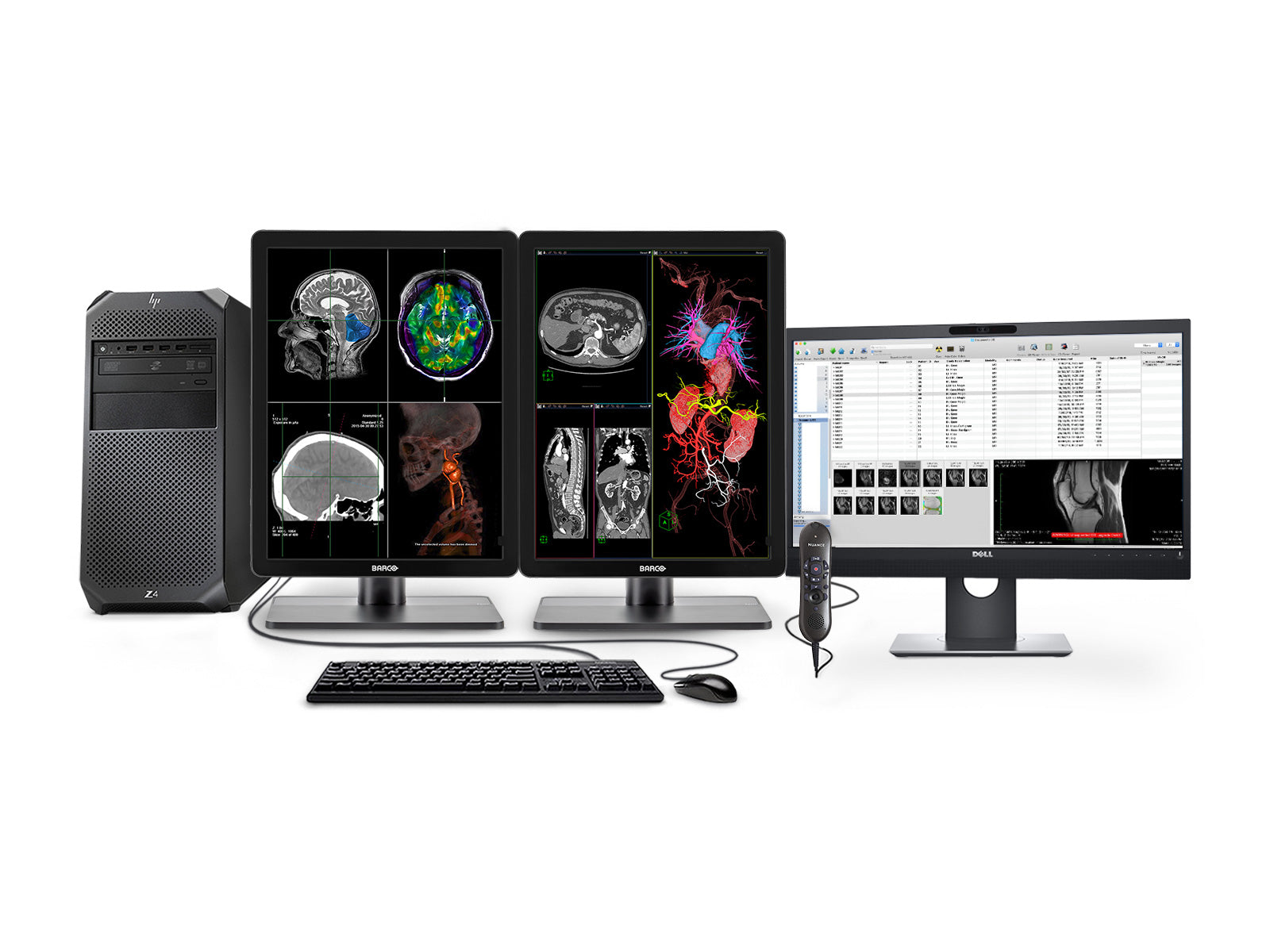 Complete PACS Gen Radiology Station | Barco Display | HP Workstation