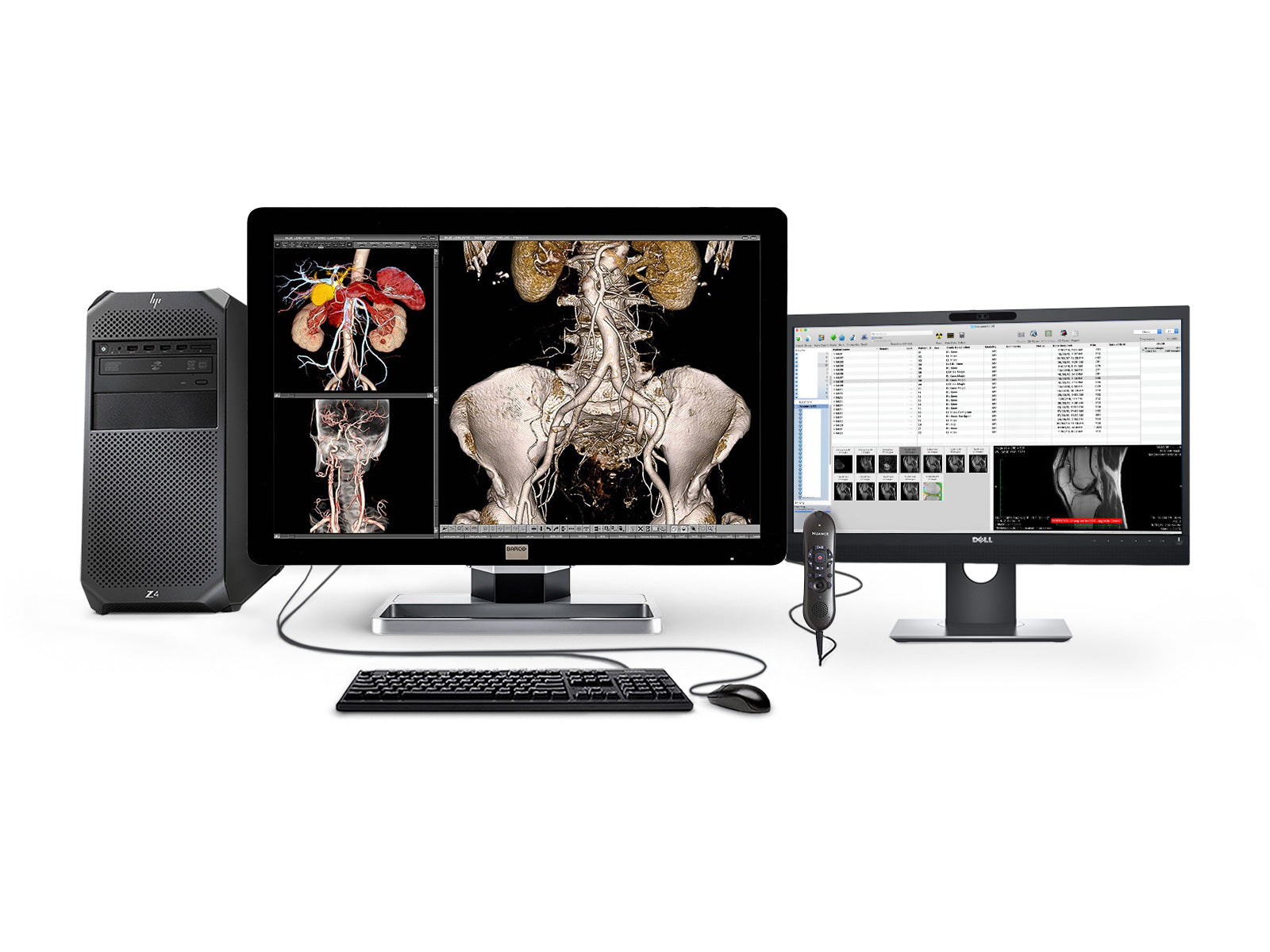 Barco Complete PACS General Radiology Station | HP Workstation