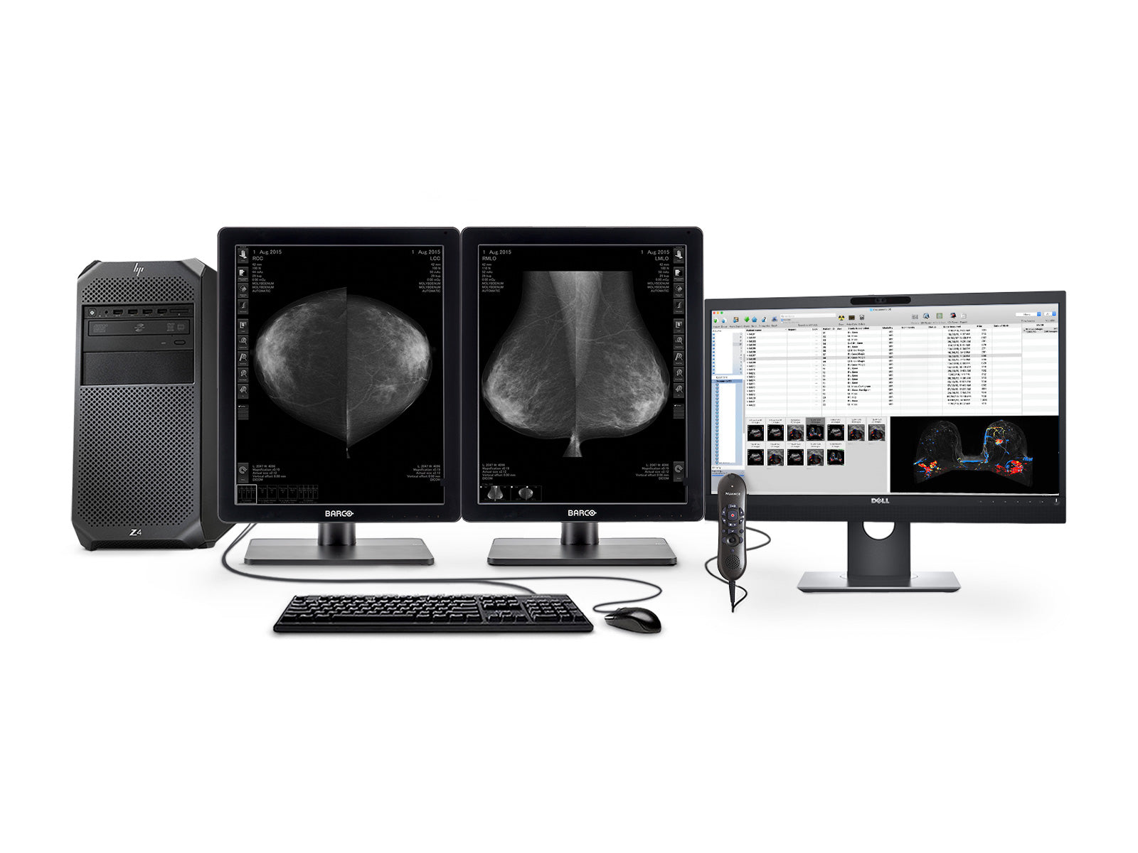 Complete Mammography Reading Station | HP Workstation