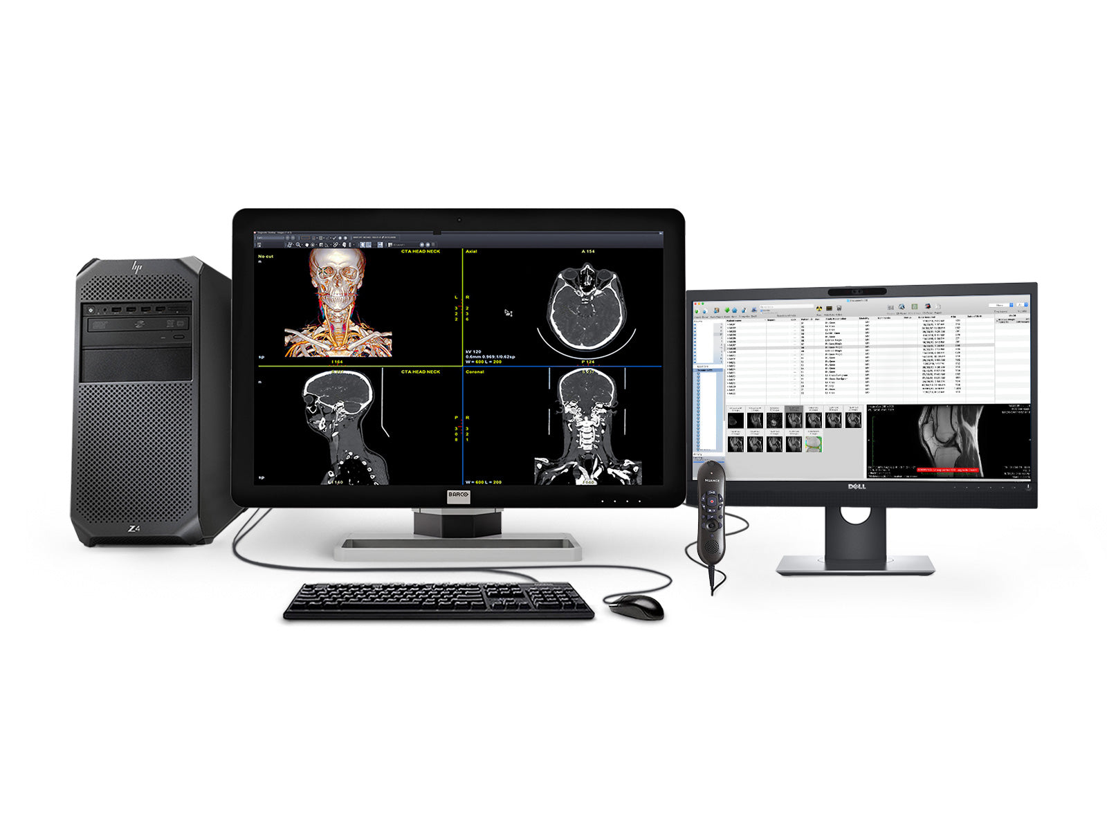 Estação de leitura de radiologia geral de Barco | Coronis 6MP MDCC-6430 | Estação de trabalho da HP | Nuance micring | Monitores de Lista de Trabalho de 24 "(6430Z4R)