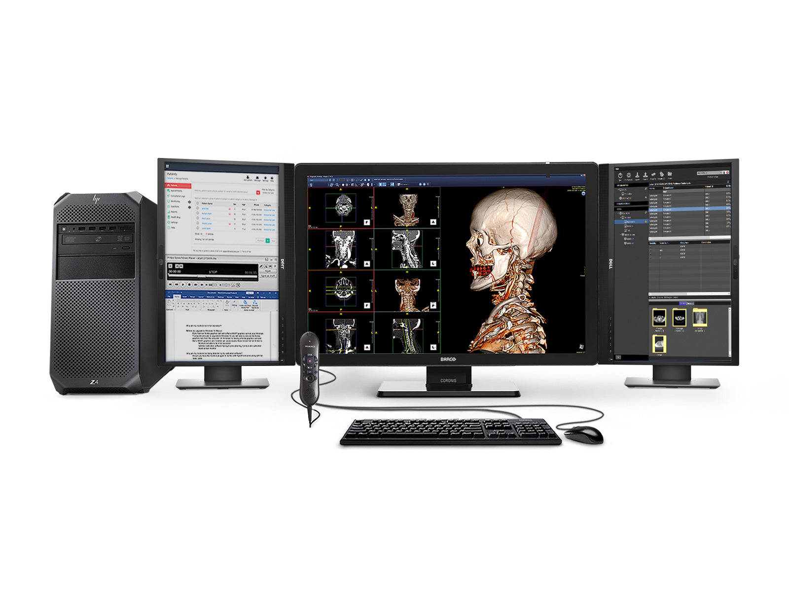 Complete PACS General Radiology Station | HP Workstation