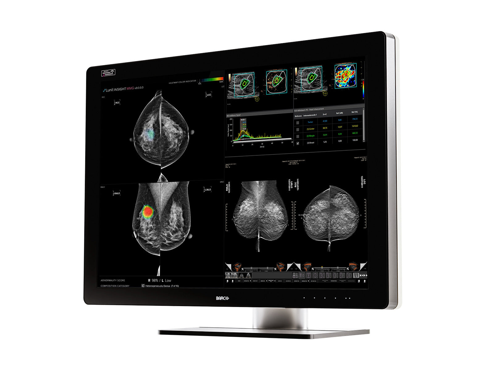 Barco Coronis UNITI MDMC-12133 12MP 33" Tomo Color LED Mammo 3D DBT PACS Display Monitors.com 