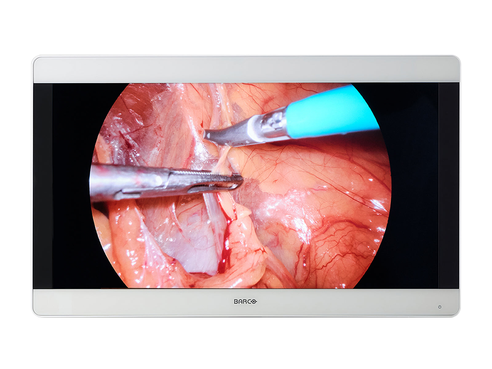 Barco MDSC-8231 32” 8MP 4K UHD Color Surgical Medical Display Monitor (K930792502) Monitors.com 