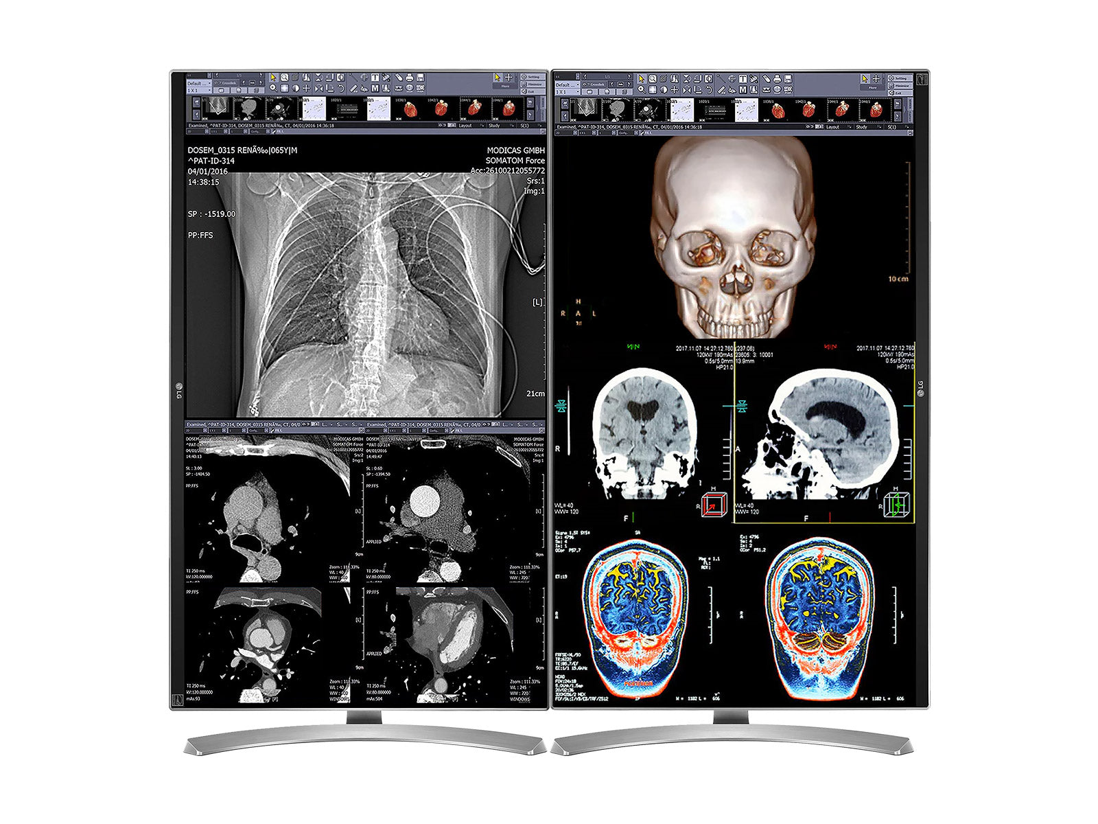 Complete Clinical Review Reading Station | 2 x LG 27" 8MP Color Clinical Review Displays | HP ZBook Studio 16 G9 | Dictation Mic | PerfectLUM Calibration Package (LGHP16G9)