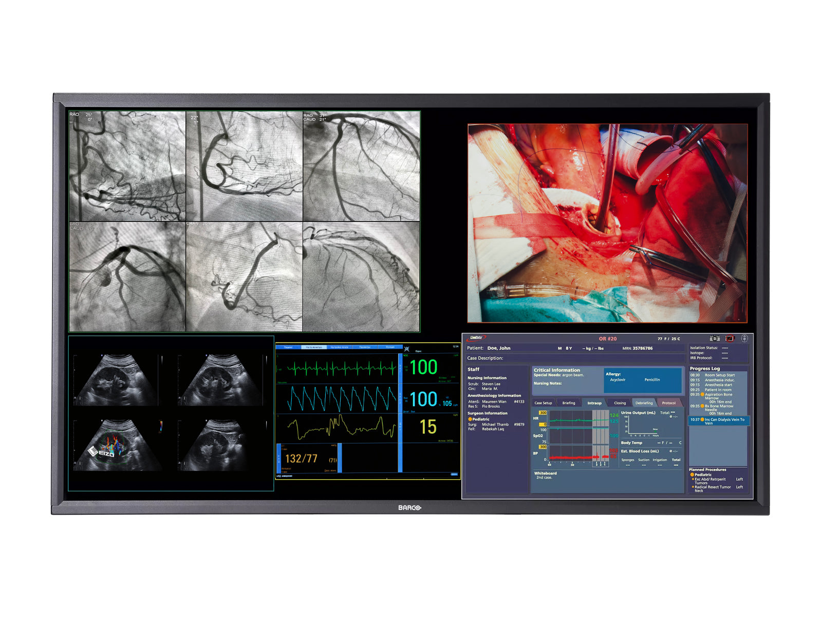 Barco MDSC-8358 58" 8MP 4K Color Surgical Medical Display Monitor (K9307938) Monitors.com 