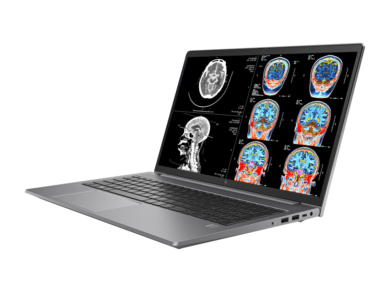 HP ZBook Power 15 G9 Mobile Radiology Workstation | 15.6" UHD 8MP+ DICOM Calibrated | Core i7-12700H @ 4.70GHz | 32GB DDR5 | 512GB NVMe SSD | NVIDIA RTX A2000 8GB | Win11 Pro Monitors.com 