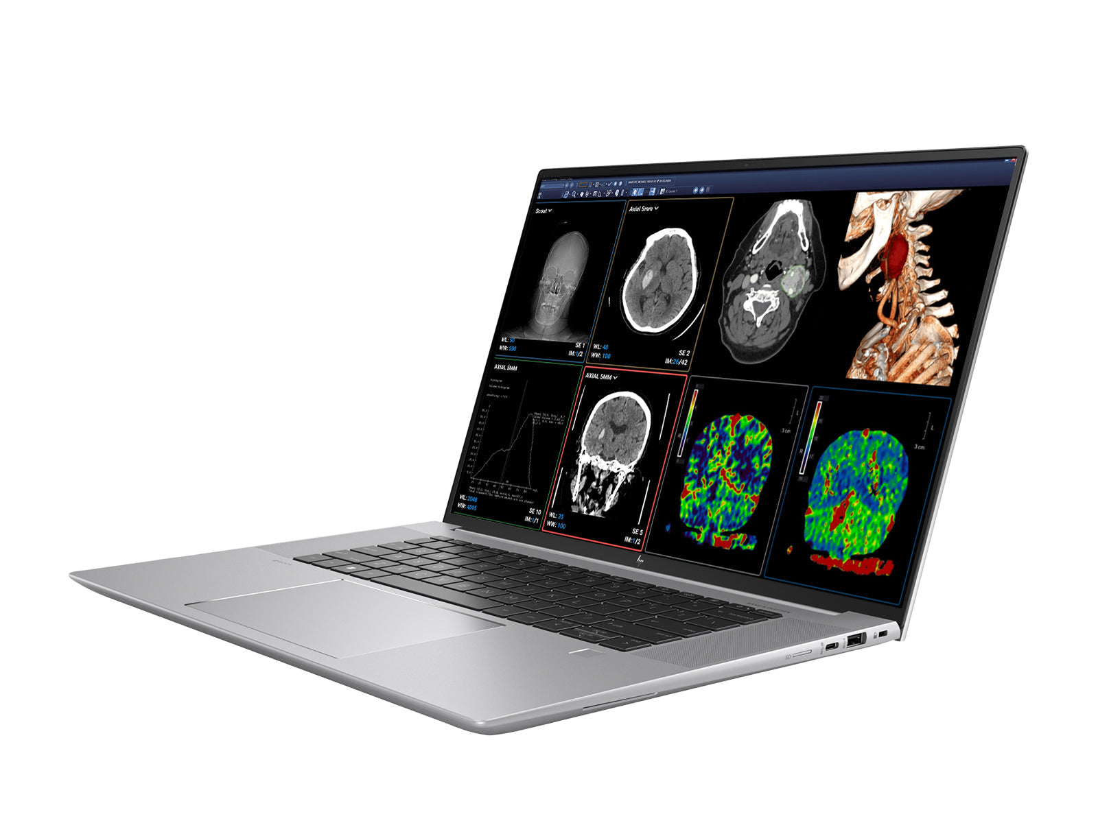 HP ZBook Studio 16 G9 Mobile Radiology Workstation | 16" WQUXGA 8MP+ DICOM Calibrated | Core i9-12900H @ 5.00GHz | 64GB DDR5 | 1TB NVMe SSD | Nvidia RTX A1000 4GB| Win11 Pro Monitors.com 