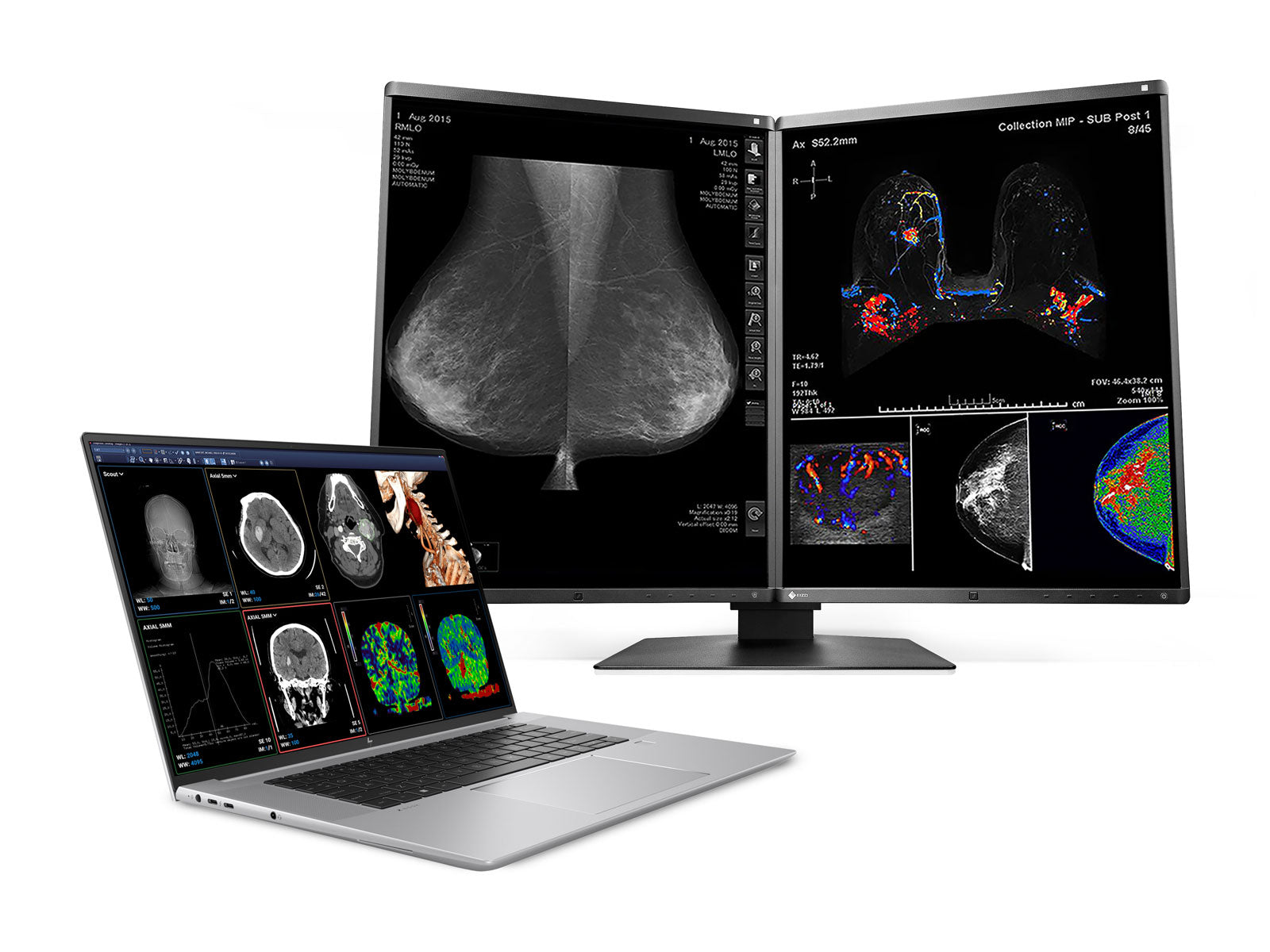 HP ZBook Studio 16 G9 Mobile Radiology Workstation | 16" UHD OLED 8MP+ DICOM Calibrated | Core i9-12900H @ 5.00GHz | 64GB DDR5 | 2TB NVMe SSD | RTX A5500 16GB | Win11 Pro Monitors.com 