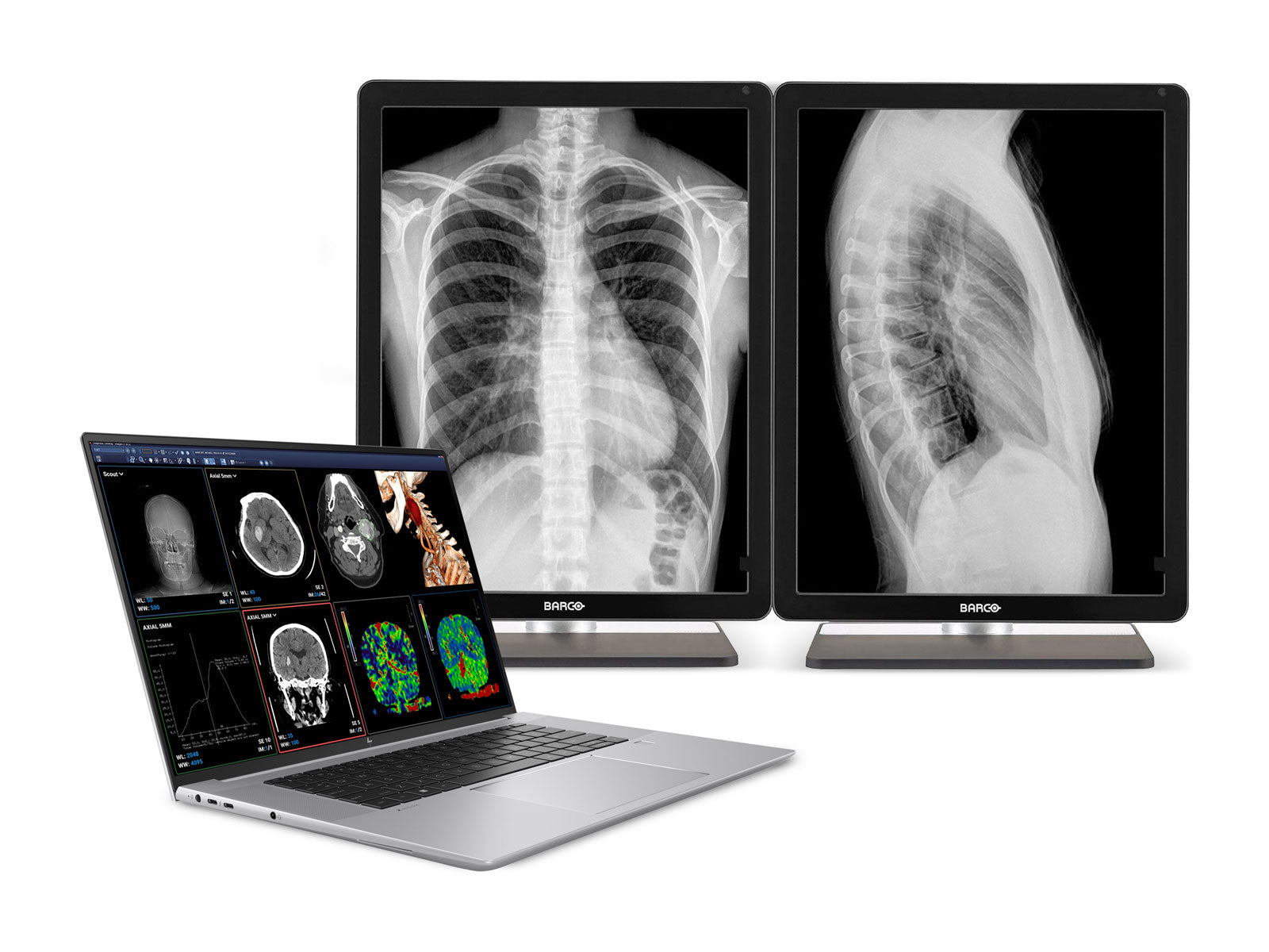 HP ZBook Studio 16 G9 Mobile Radiology Workstation | 16" WQUXGA OLED 8MP+ DICOM Calibrated | Core i7-12800H @ 4.80GHz | 64GB DDR5 | 1TB NVMe SSD | Nvidia RTX A4500 16GB | Win11 Pro Monitors.com 