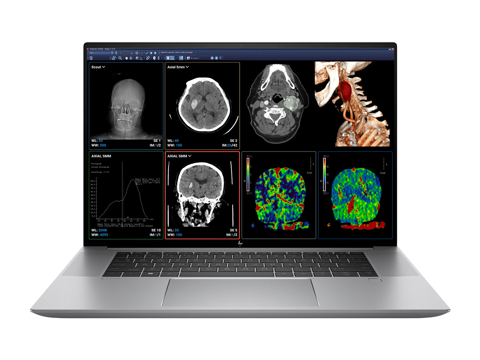 Station de lecture d'examen clinique complète | 2 écrans d'examen clinique couleur LG 27" 8MP | HP ZBook Studio 16 G9 | Micro de dictée | Pack d'étalonnage PerfectLUM (LGHP16G9)