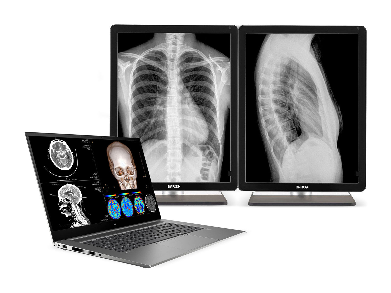 HP ZBook Studio 15 G8 Mobile Radiology Workstation | 15.6" OLED 8MP+DICOM Calibrated | Core i7-11800H @ 4.60GHz | 32GB DDR4 | 512GB NVMe SSD | Nvidia RTX 3060 6GB | Win11 Pro Monitors.com 