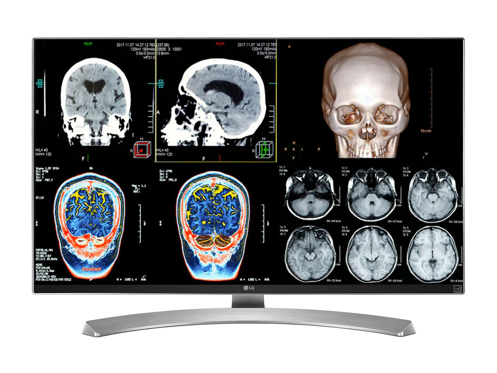 Complete Clinical Review Reading Station | 2 x LG 27" 8MP Color Clinical Review Displays | HP ZBook Studio 16 G9 | Dictation Mic | PerfectLUM Calibration Package (LGHP16G9)