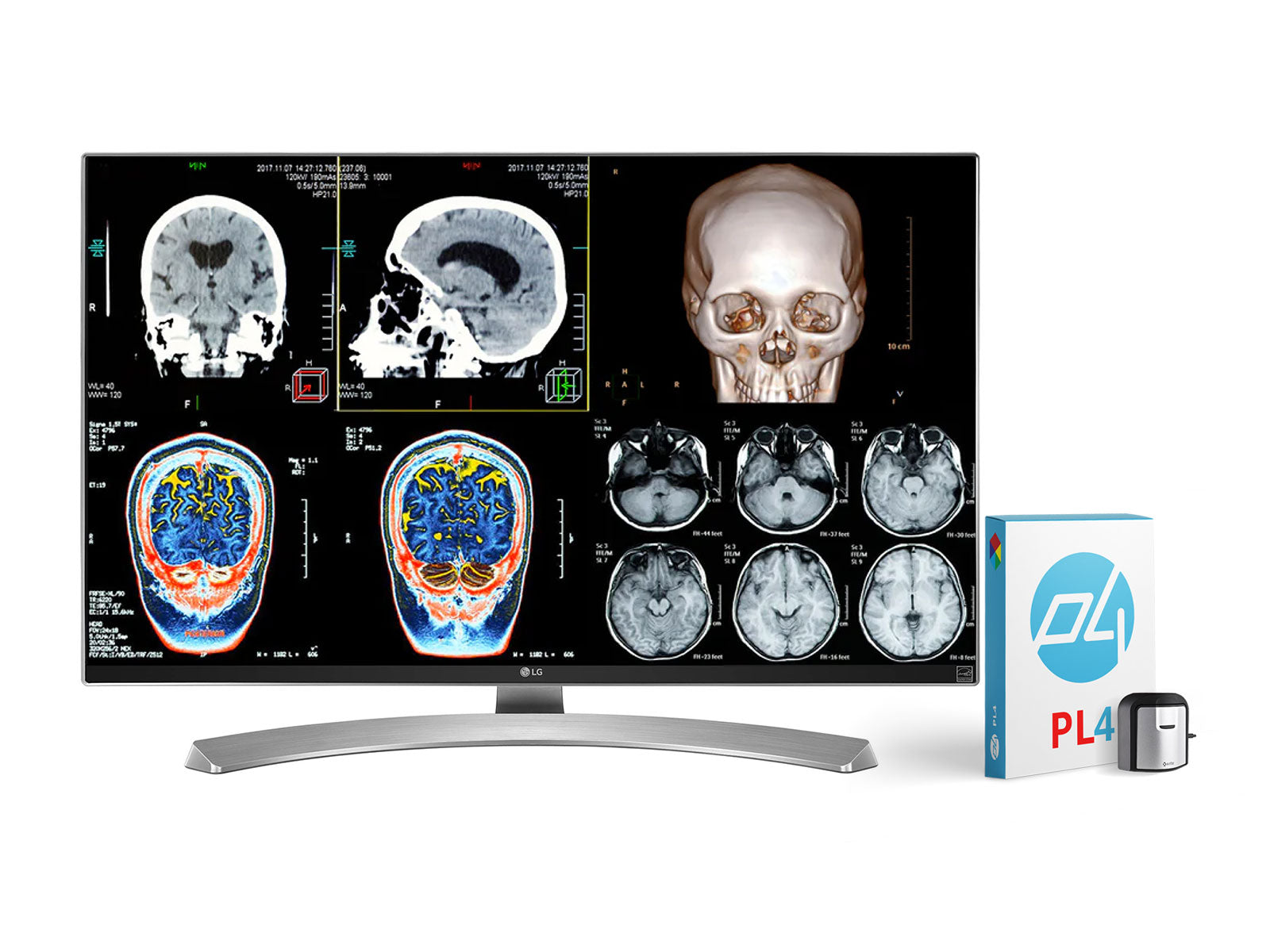 Complete Clinical Review Reading Station | 2 x LG 27" 8MP Color Clinical Review Displays | HP ZBook Studio 16 G9 | Dictation Mic | PerfectLUM Calibration Package (LGHP16G9)