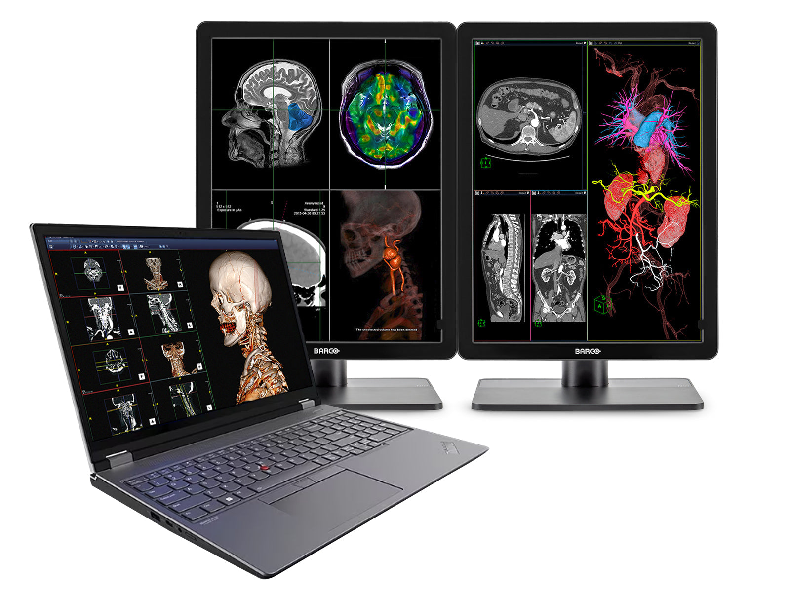 Lenovo ThinkPad P16 Mobile Radiology Workstation | 8MP+ UHD DICOM 600nits 16" Display | Intel Core i9-12900HX @ 5.0GHz | 128GB DDR5 | 1TB NVMe SSD | RTX A4500 16GB | Win10-11 Pro Monitors.com 