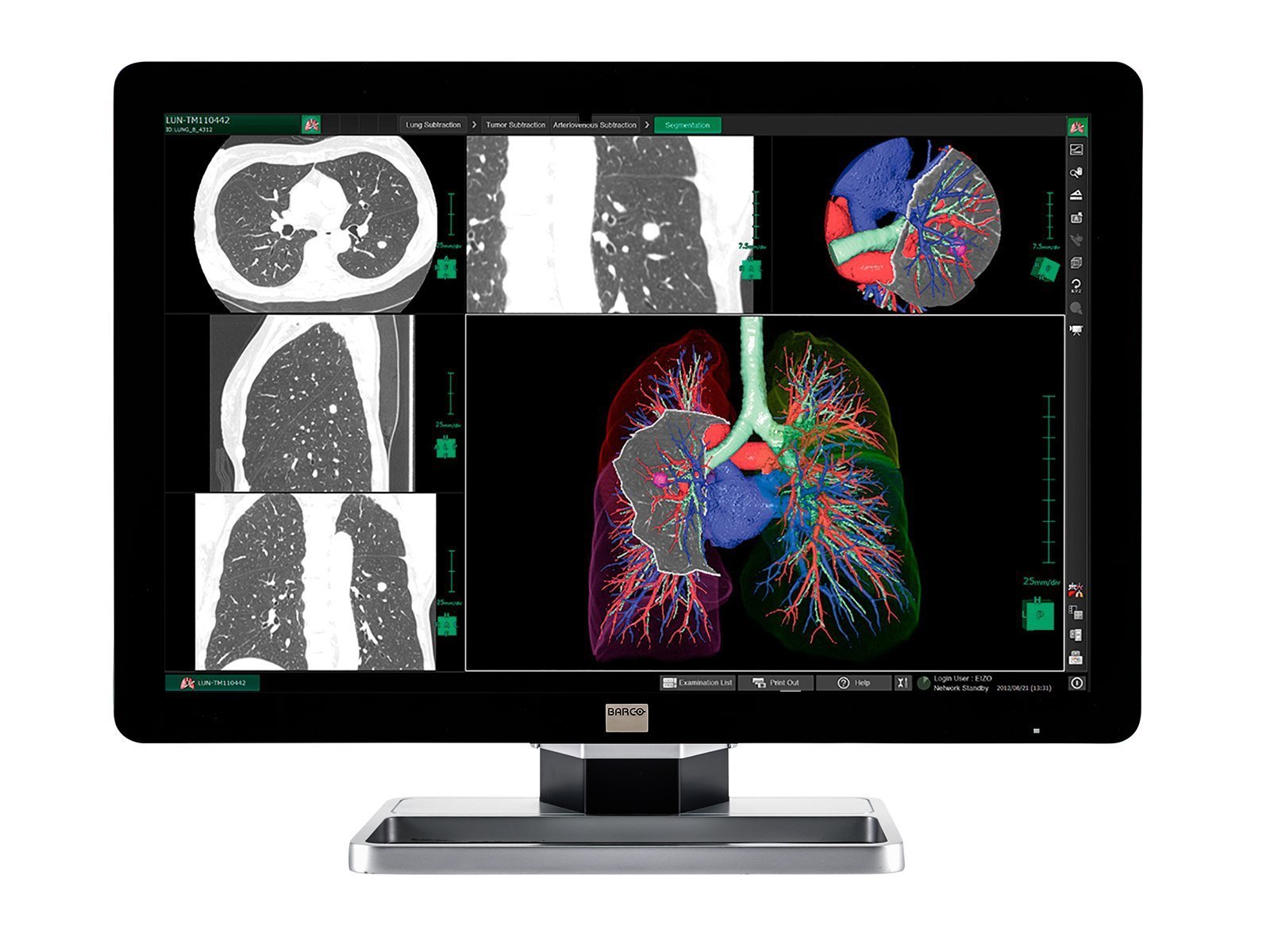 Complete PACS General Radiology Station | Barco 6MP Color LCD Display | HP Workstation | Dictation Mic | Worklist Monitor (6130Z4) (Copy) Monitors.com 