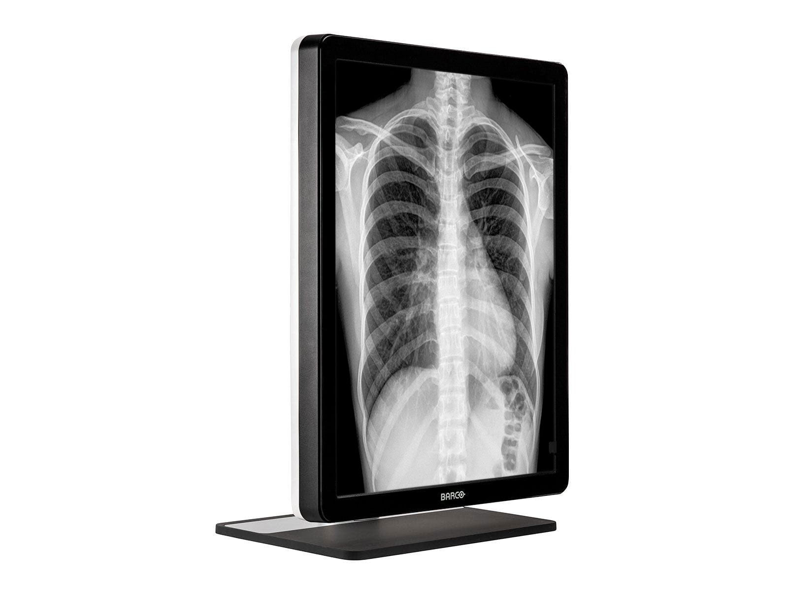 Barco Coronis MDCG-3221 3MP 21" Grayscale LED General Radiology Diagnostic Display Monitors.com 