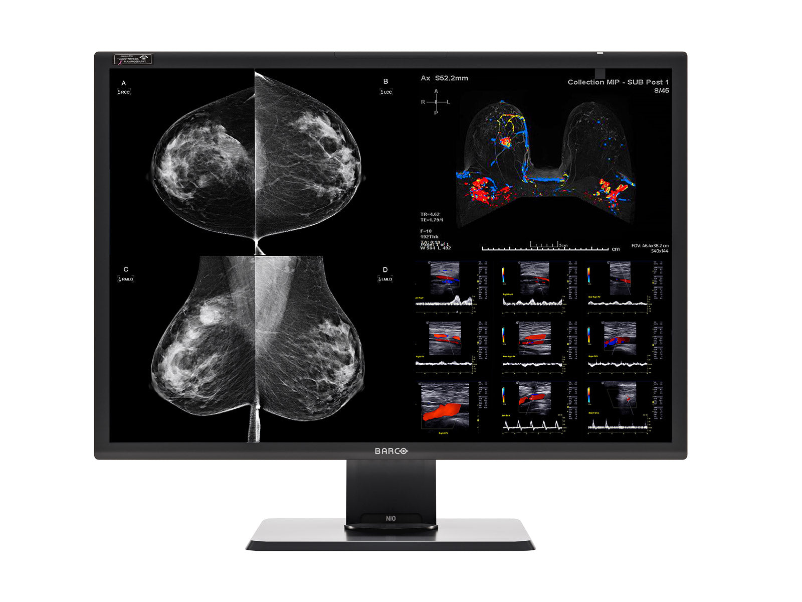 Complete Mammography Reading Station | Barco 12MP Color Display | Lenovo Workstation | Dictation Mic | Worklist Monitors (12130P520)