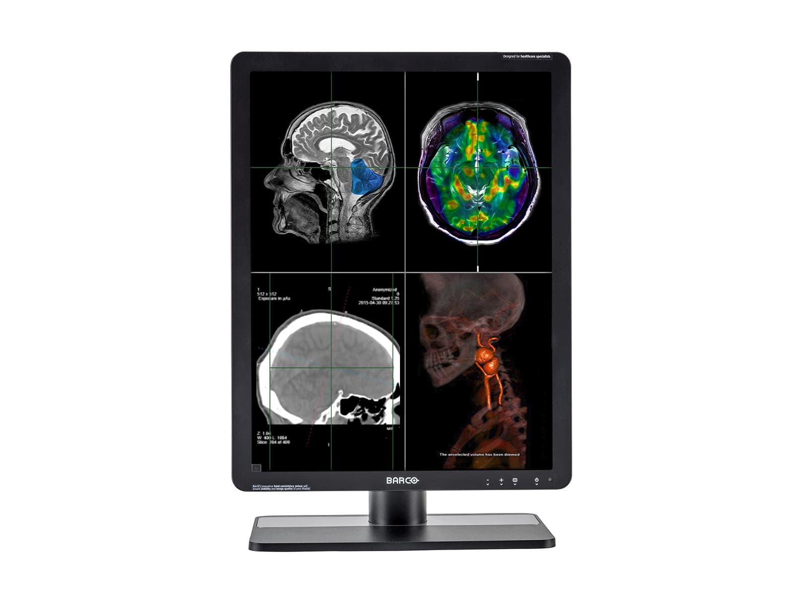 Complete Mammography Reading Station | Barco 5MP Color LED Monitor | HP Workstation | Dictation Microphone (LFH3510)| Worklist Monitors (61212321R) Monitors.com 