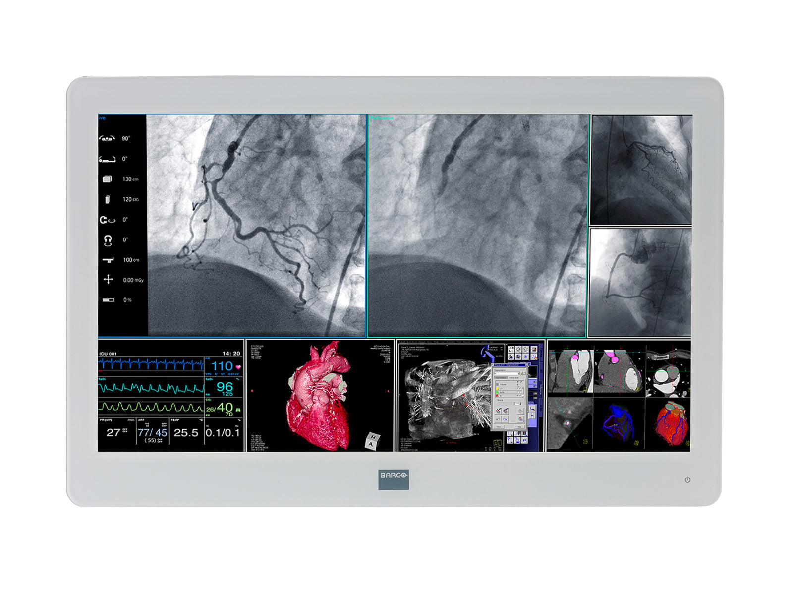 Barco MDSC-2226 26" 2MP Full HD Color Surgical Medical Display Monitor (K9307907)