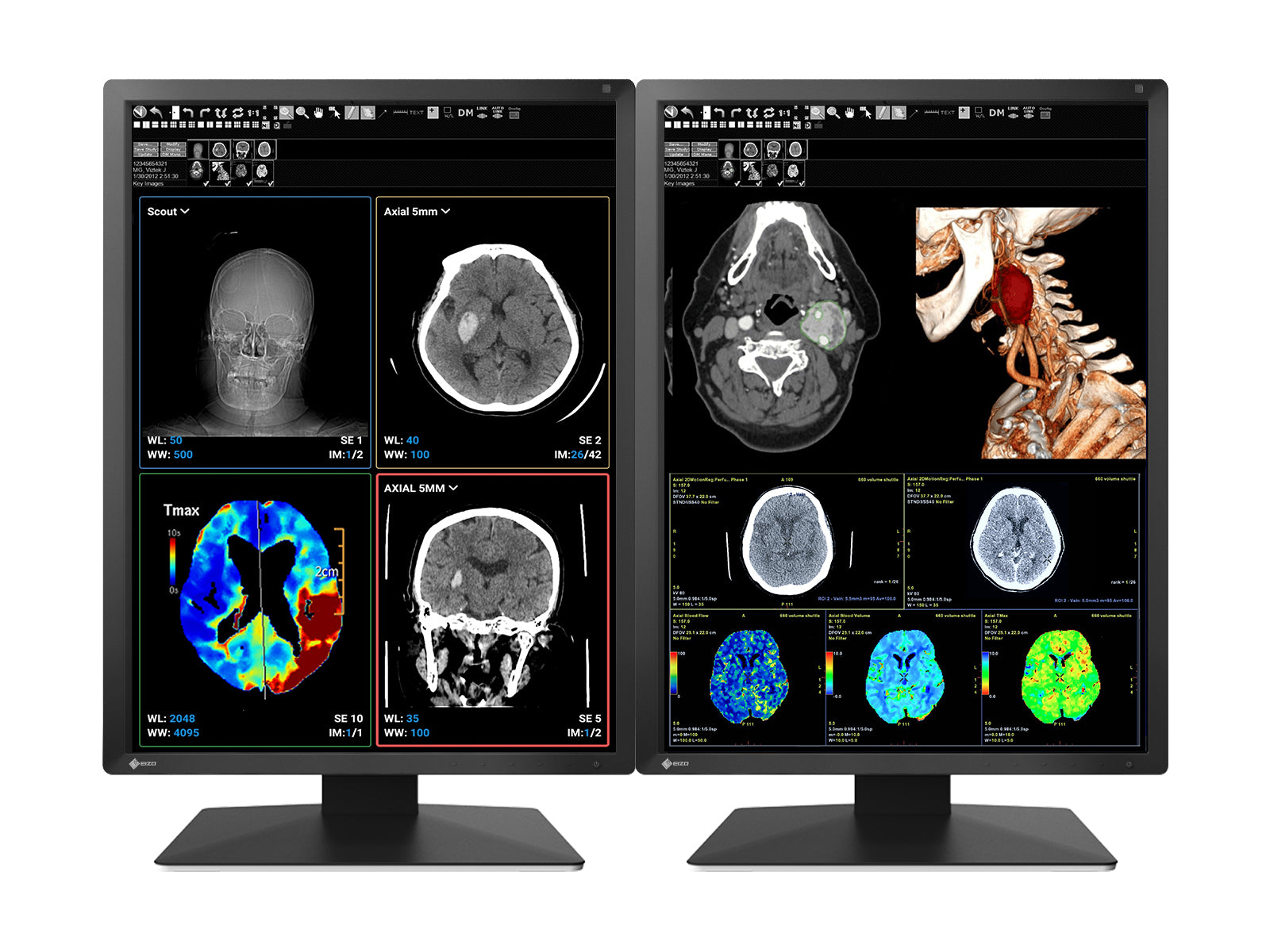 Eizo RadiForce MX217 2MP 21" Color LED Medical Display Monitor (MX217-BK) Monitors.com 