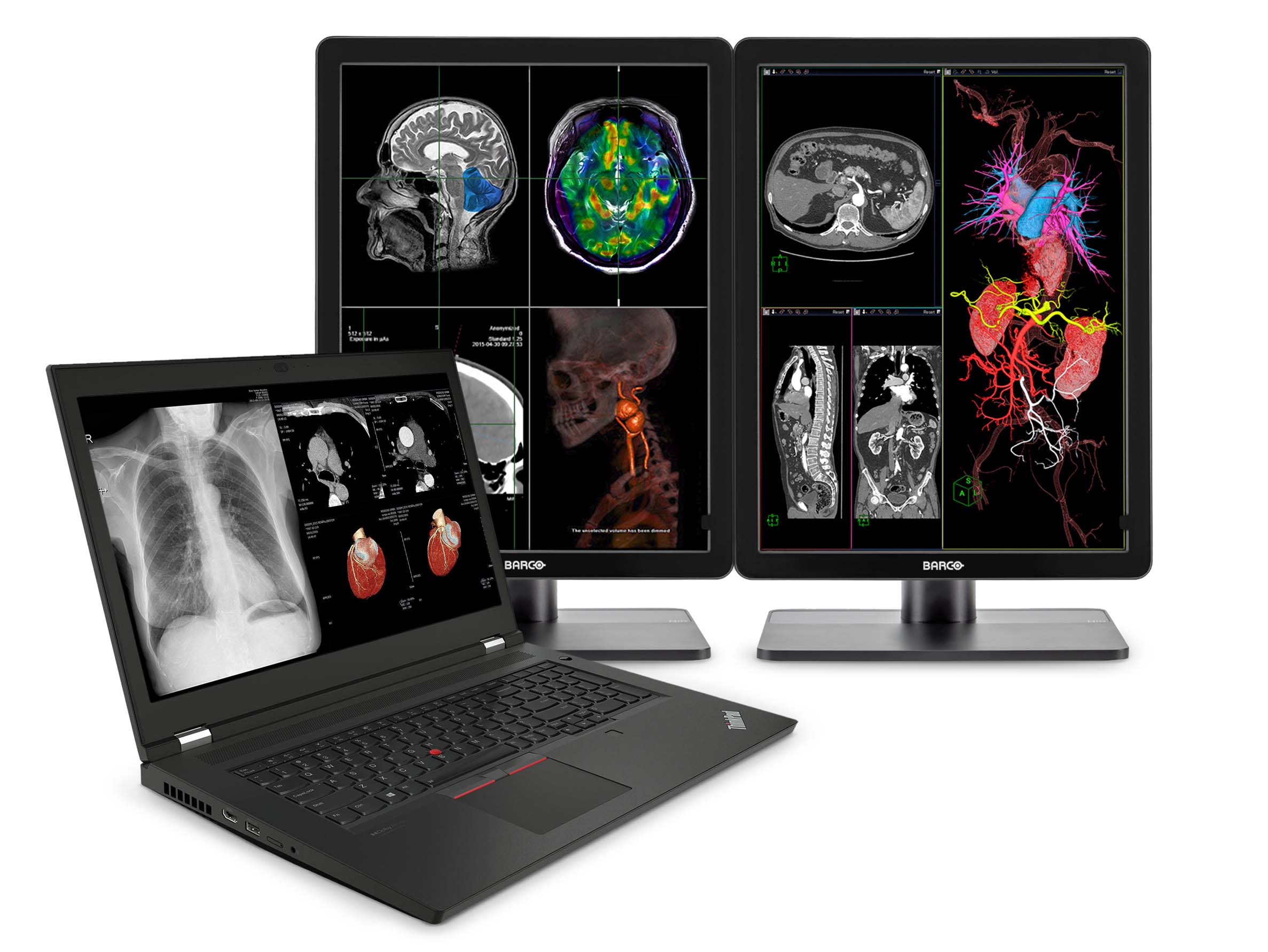 Lenovo ThinkPad P17 G2 Mobile Radiology Workstation | 17.3" 8MP DICOM Calibrated | Intel Core -i7-11850H @ 4.80GHz | 128GB DDR4 | 1TB NVMe SSD | NVIDIA RTX A5000 16GB | Win10 Pro Monitors.com 