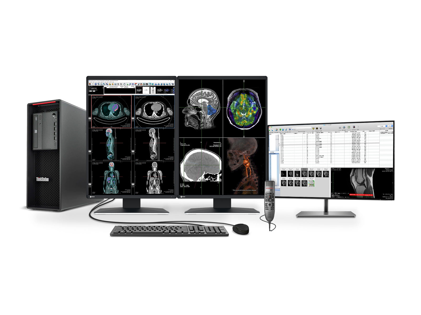 Complete PACS Gen Radiology Station | Eizo Displays | P520 Workstation