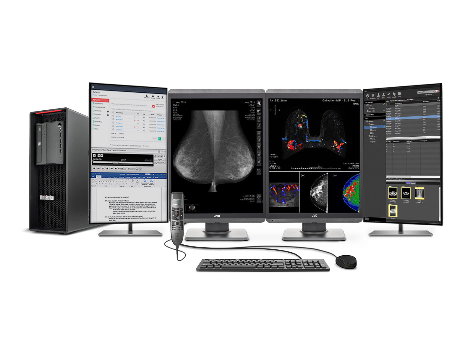 Complete Mammography Reading Station | JVC Totoku 5MP Color 3D-DBT Displays | Lenovo Workstation | Dictation Mic | Worklist Monitors (S500P520N)