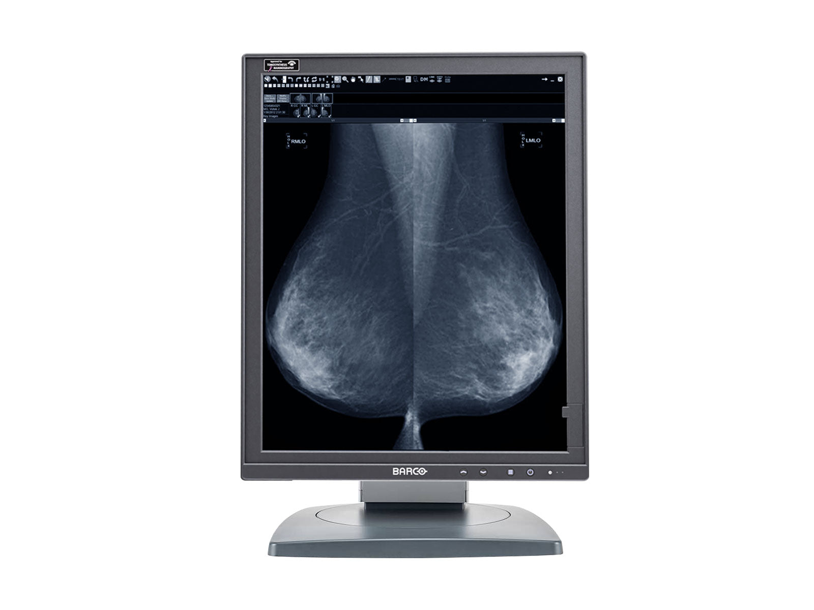 Barco Coronis MDMG-5221 5MP 21" Grayscale Tomosynthesis LED 3D-DBT Mammography Display Monitors.com 