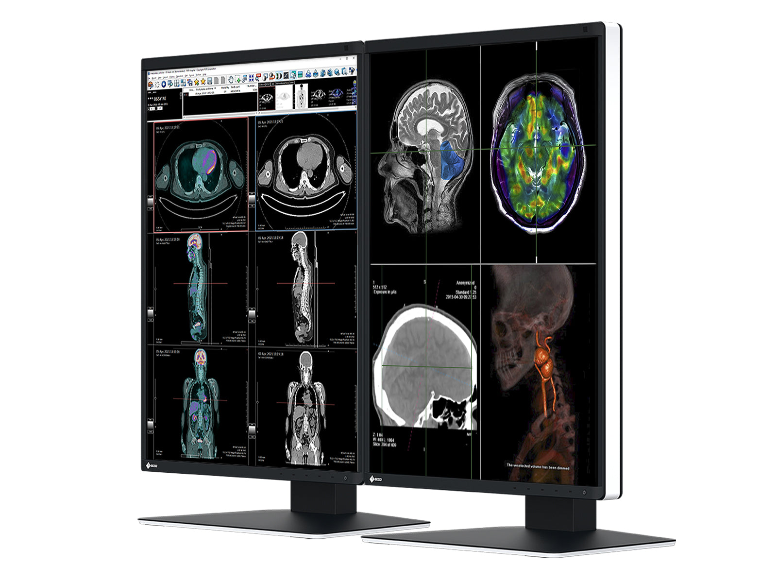 Eizo RadiForce RX370 3MP 21" Color LED General Radiology Diagnostic PACS Display (RX370) Monitors.com 