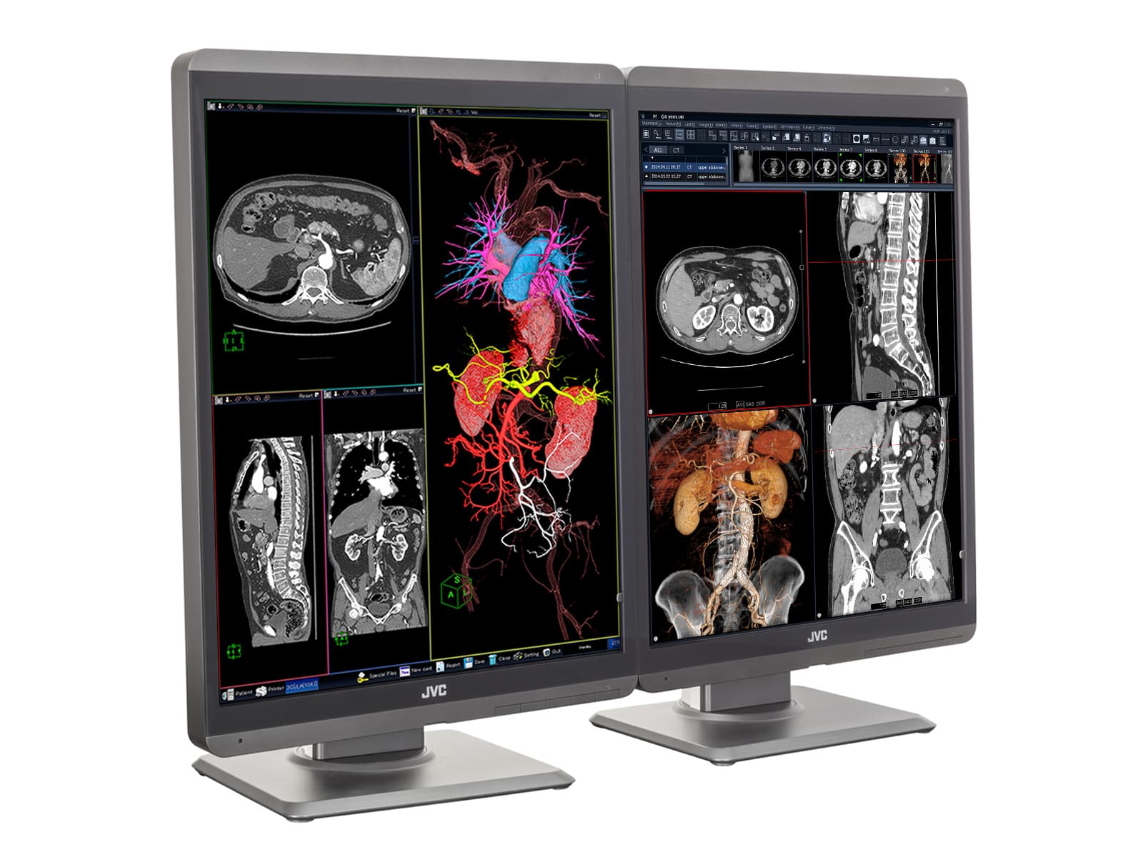 JVC Totoku CL-S300 3MP 21" Color LED General Radiology Diagnostic Display Monitors (CL-S300) Monitors.com 