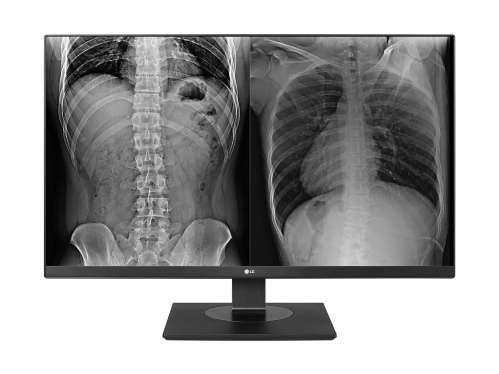 LG 27HJ713C 8MP 27" Color Clinical Review Display Monitor (27HJ713C-B) Monitors.com 