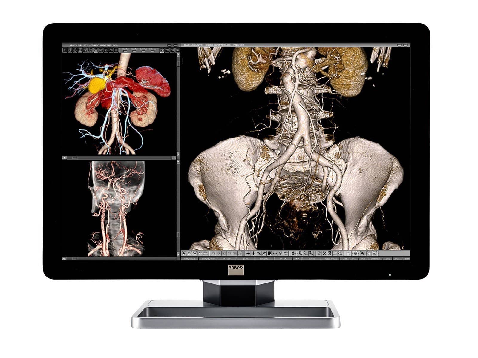 Barco Coronis Fusion MDCC-4330 4MP 30" Color LED General Radiology PACS Display Monitors.com 