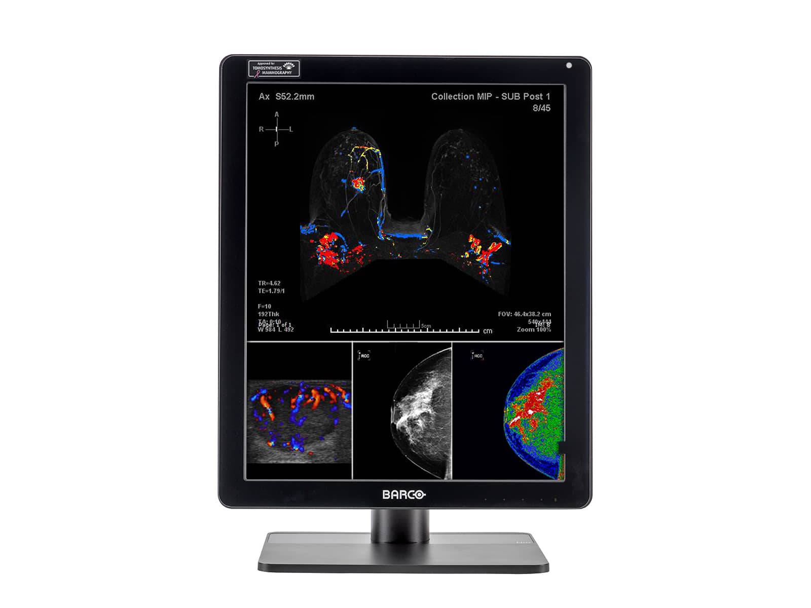 Imagen - Barco Nio MDNC-6121 5MP 21" Color LED Mammo 3D-DBT Breast Imaging Display Monitors.com 