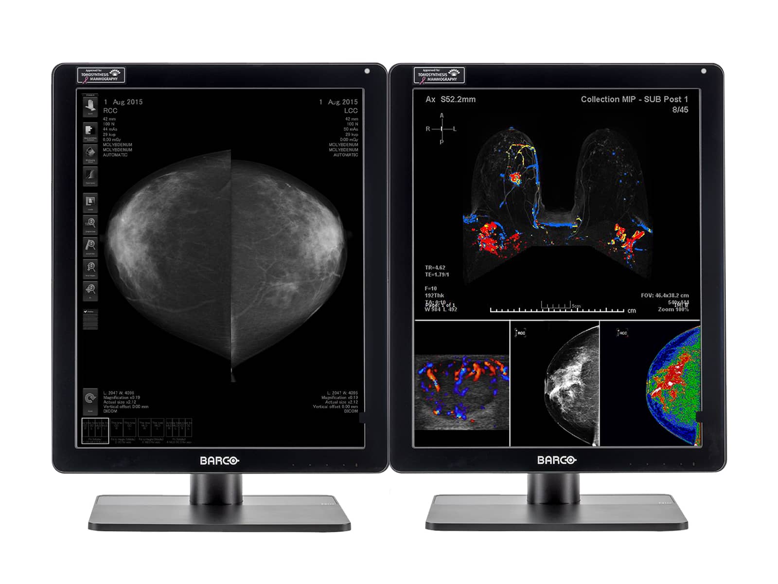 Imagen - Barco Nio MDNC-6121 5MP 21" Color LED Mammo 3D-DBT Breast Imaging Display Monitors.com 