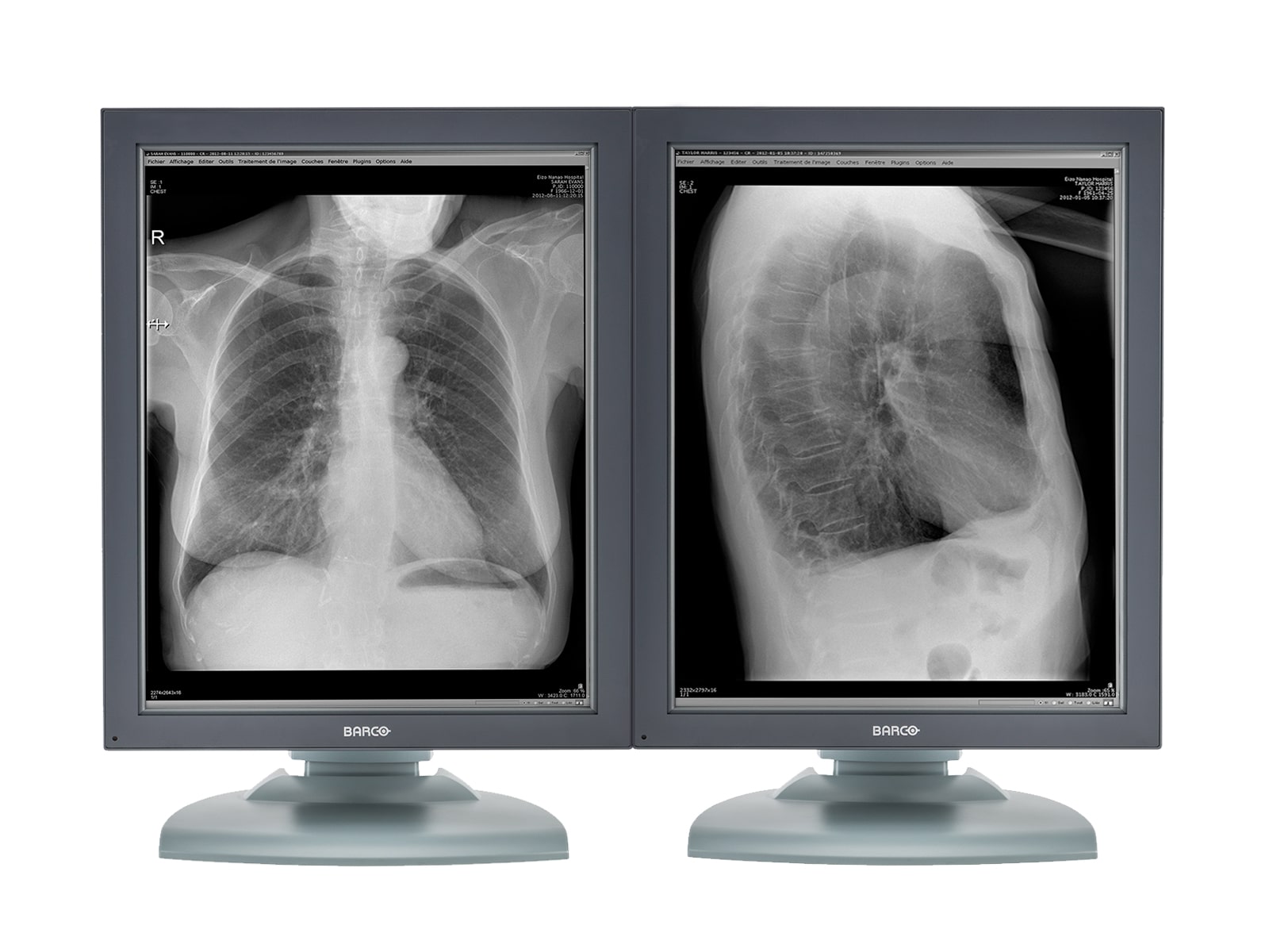 Barco Nio MDNG-2121 2MP 21" Grayscale Medical Diagnostic Radiology Monitor Monitors.com 