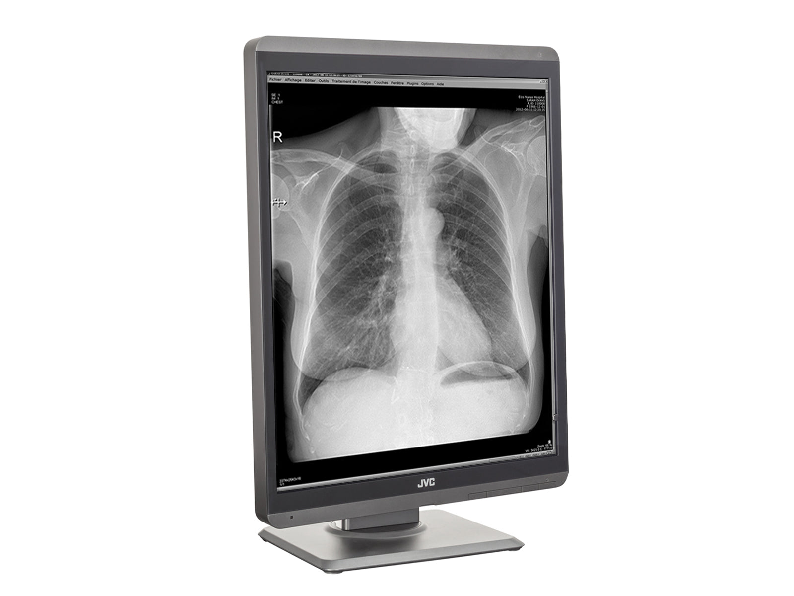 JVC Totoku MS-S200 2MP 21" Grayscale Diagnostic Radiology Display Monitor (MS-S200) Monitors.com 