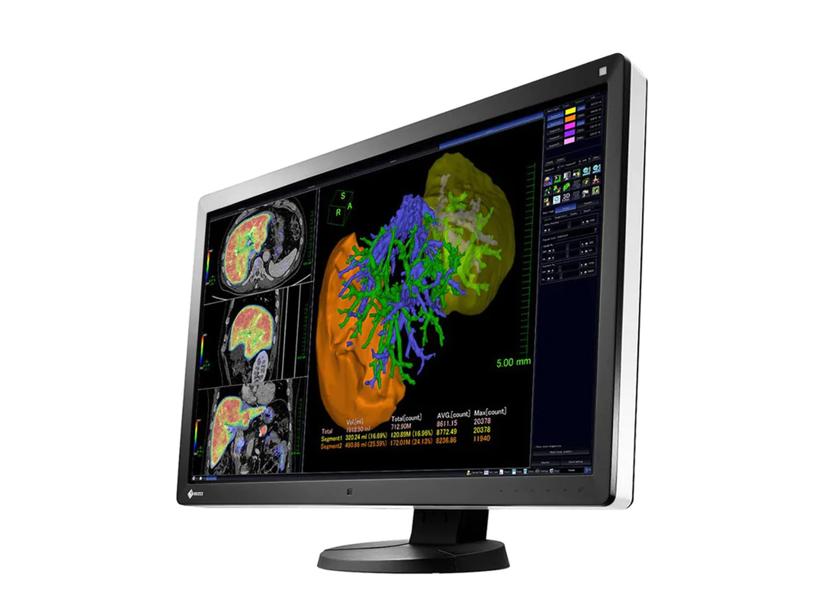 Eizo RadiForce RX650 6MP 30" Color LED General Radiology PACS Display (RX650) Monitors.com 