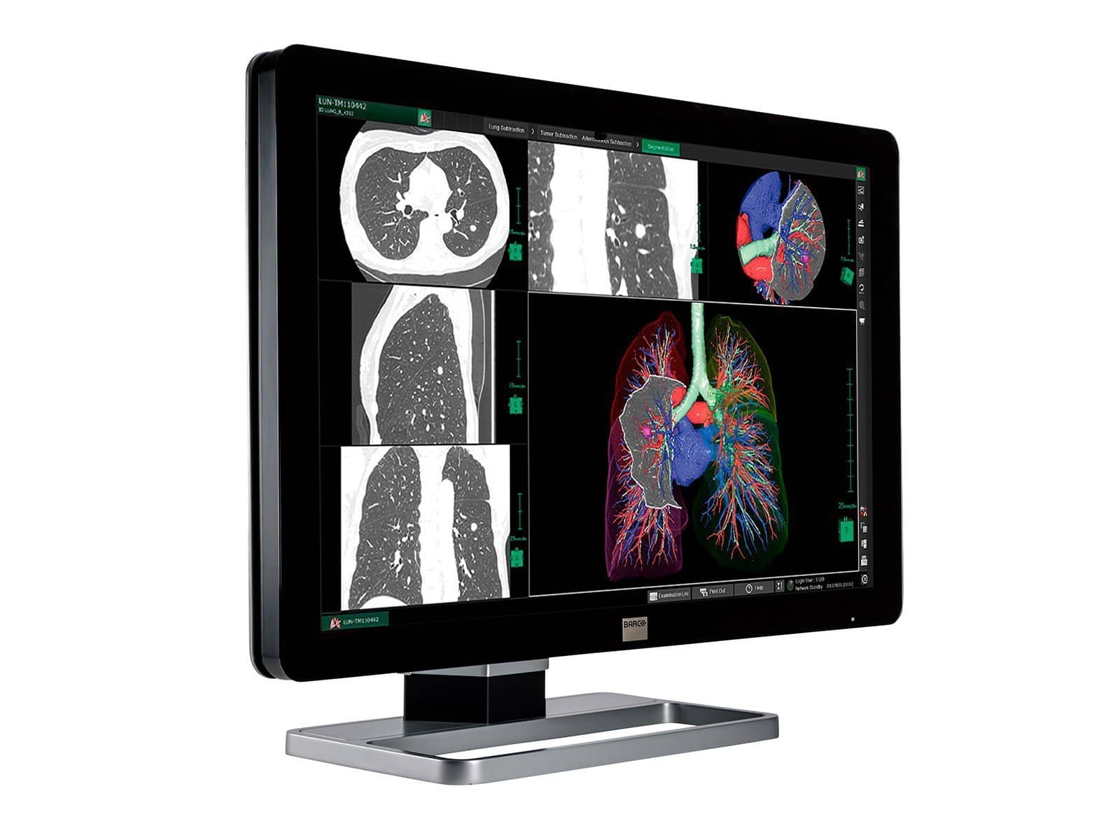 Barco Coronis Fusion MDCC-6330 6MP 30" Color LED General Radiology PACS Display Monitors.com 