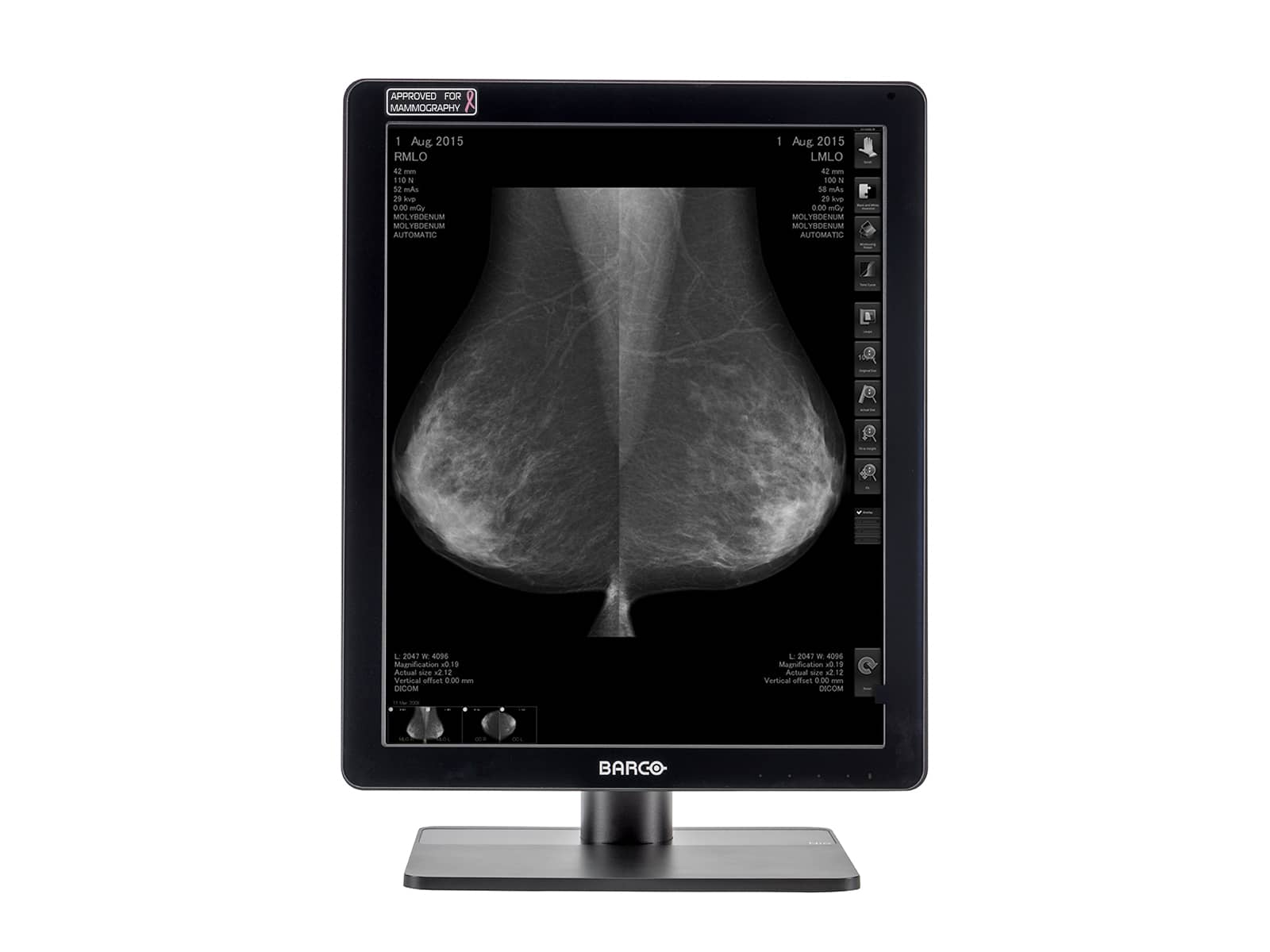 Barco Coronis MDCG-5221 5MP 21" Grayscale LED Mammo 3D-DBT Breast Imaging Display Monitors.com 