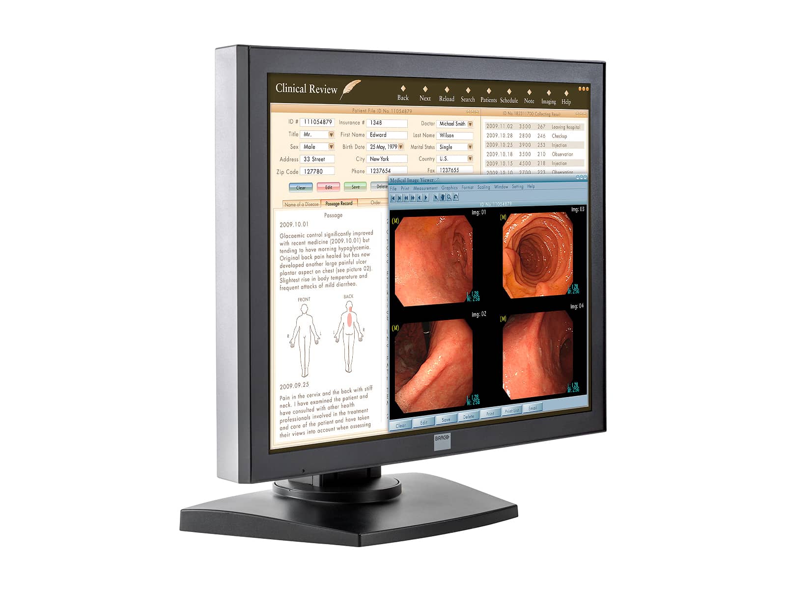 Barco MDRC-1119 1MP 19" Color Clinical Review Display Monitors.com 