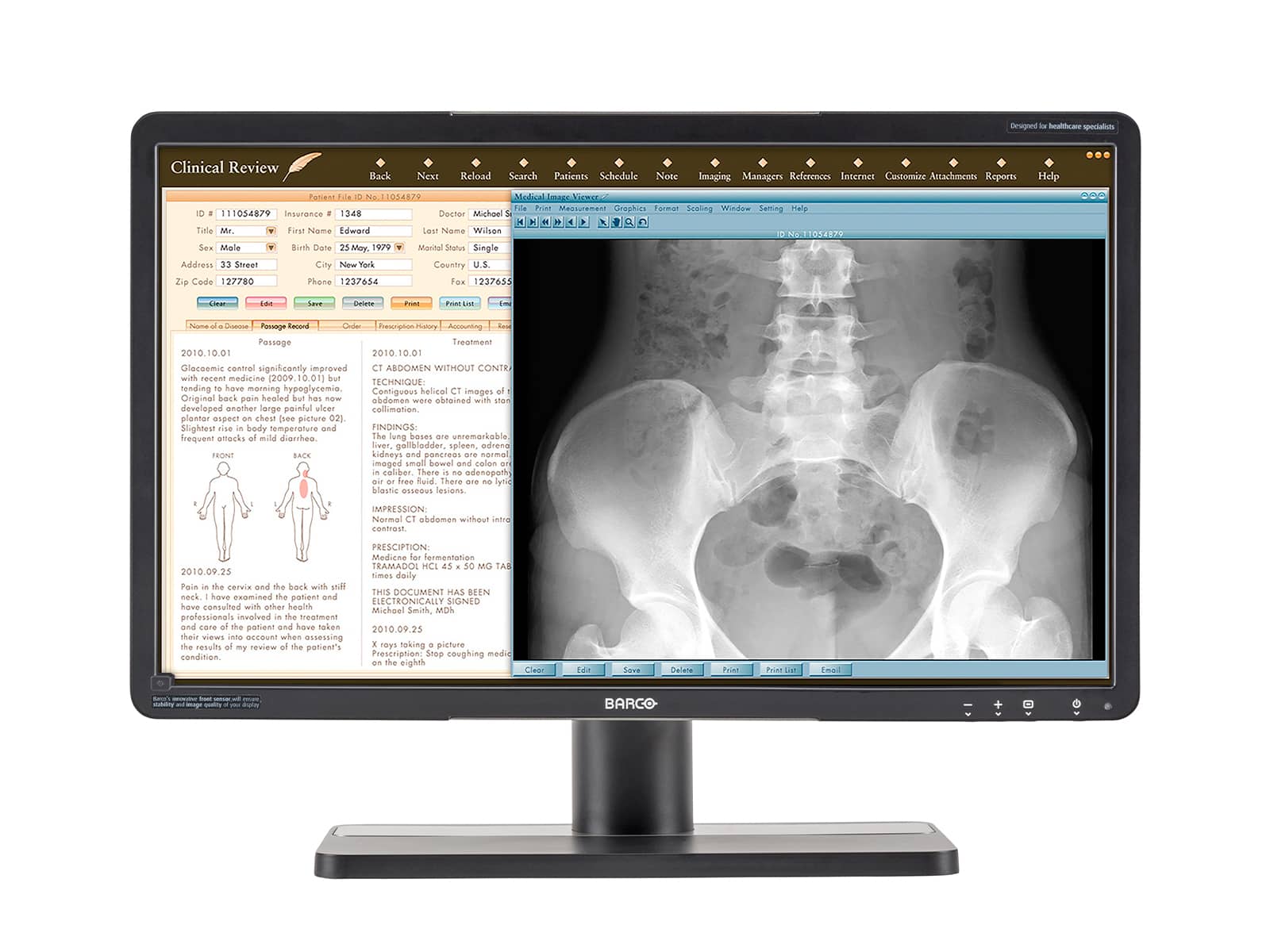 Barco Eonis MDRC-2224 WUXGA 24" 2MP Color LED Clinical Review Display Monitor Monitors.com 