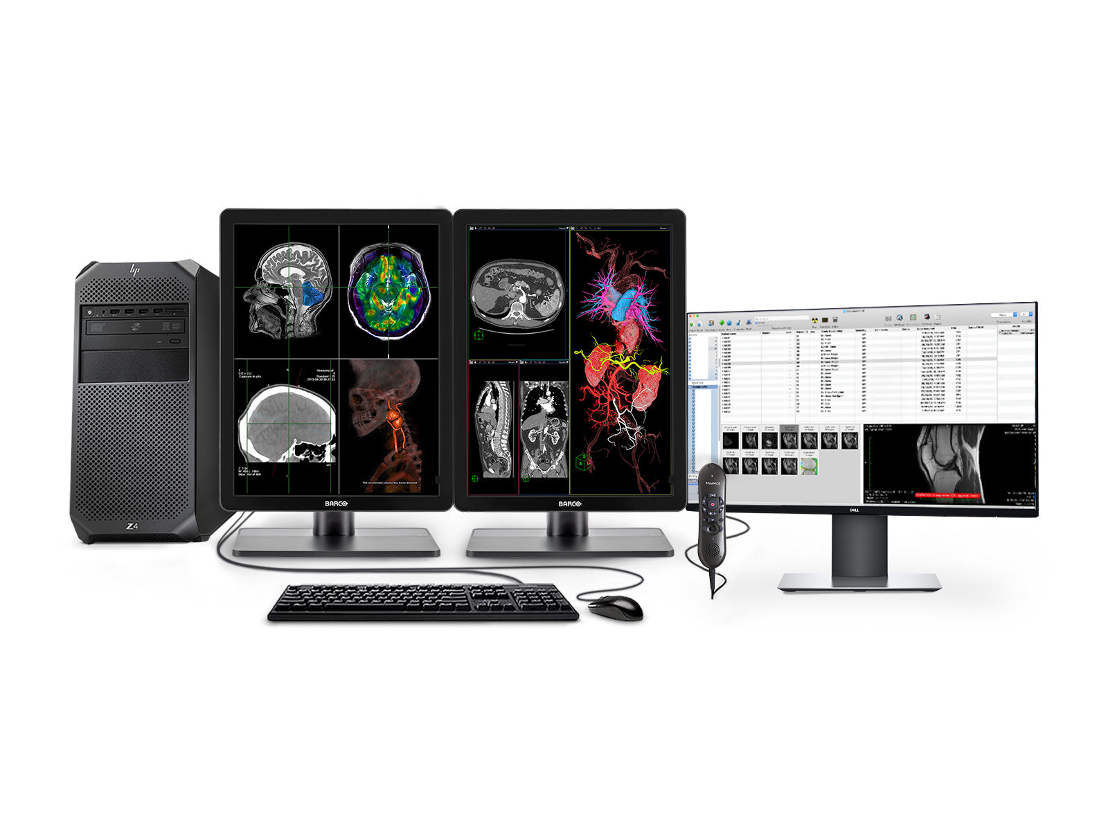 Complete PACS Gen Radiology Station | Barco Display | HP Workstation