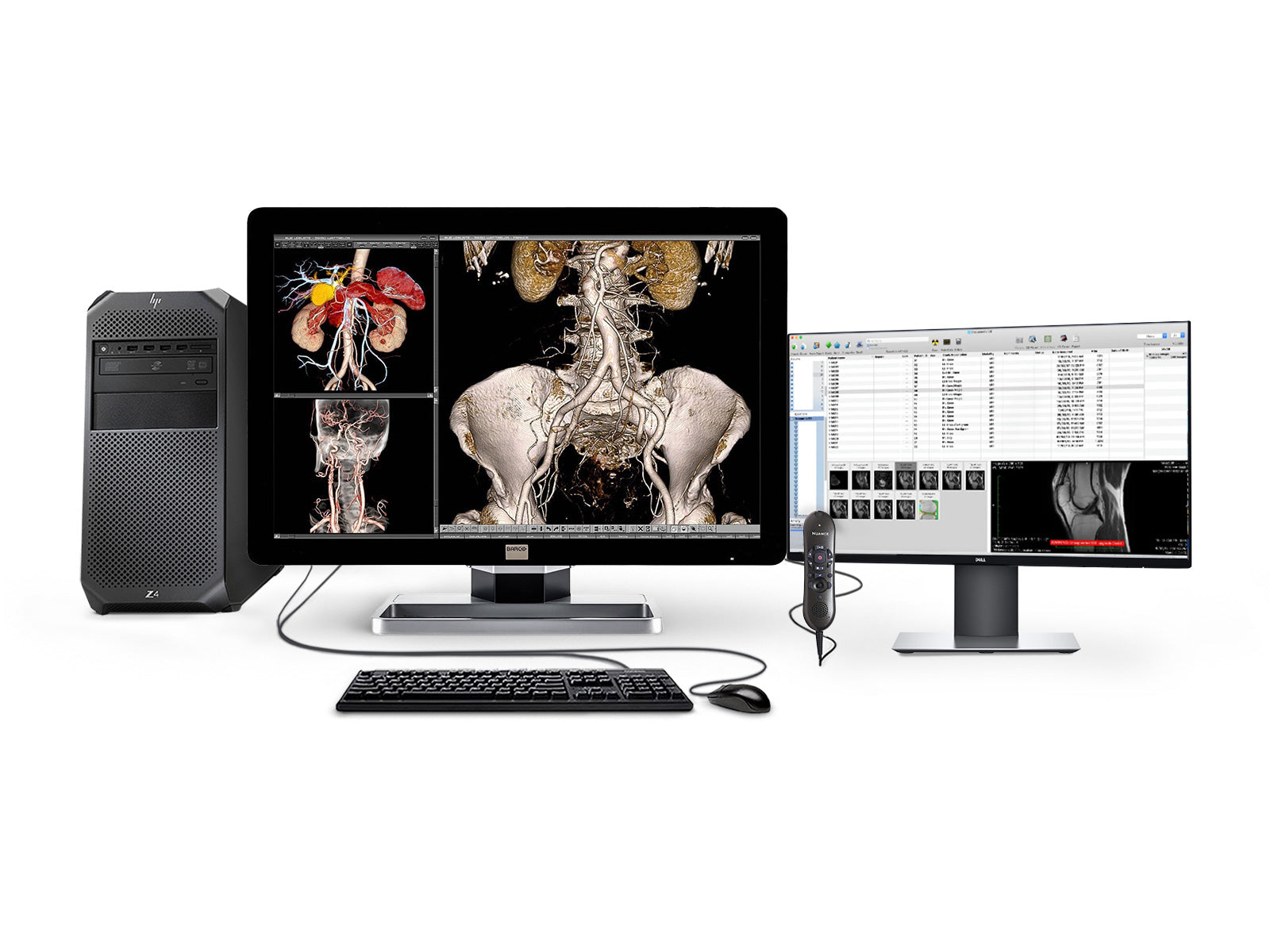 Barco Complete PACS General Radiology Station | HP Workstation