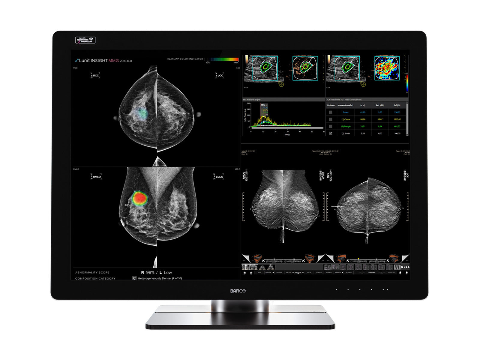 Complete Mammography | Barco 12MP Color Display | HP Workstation