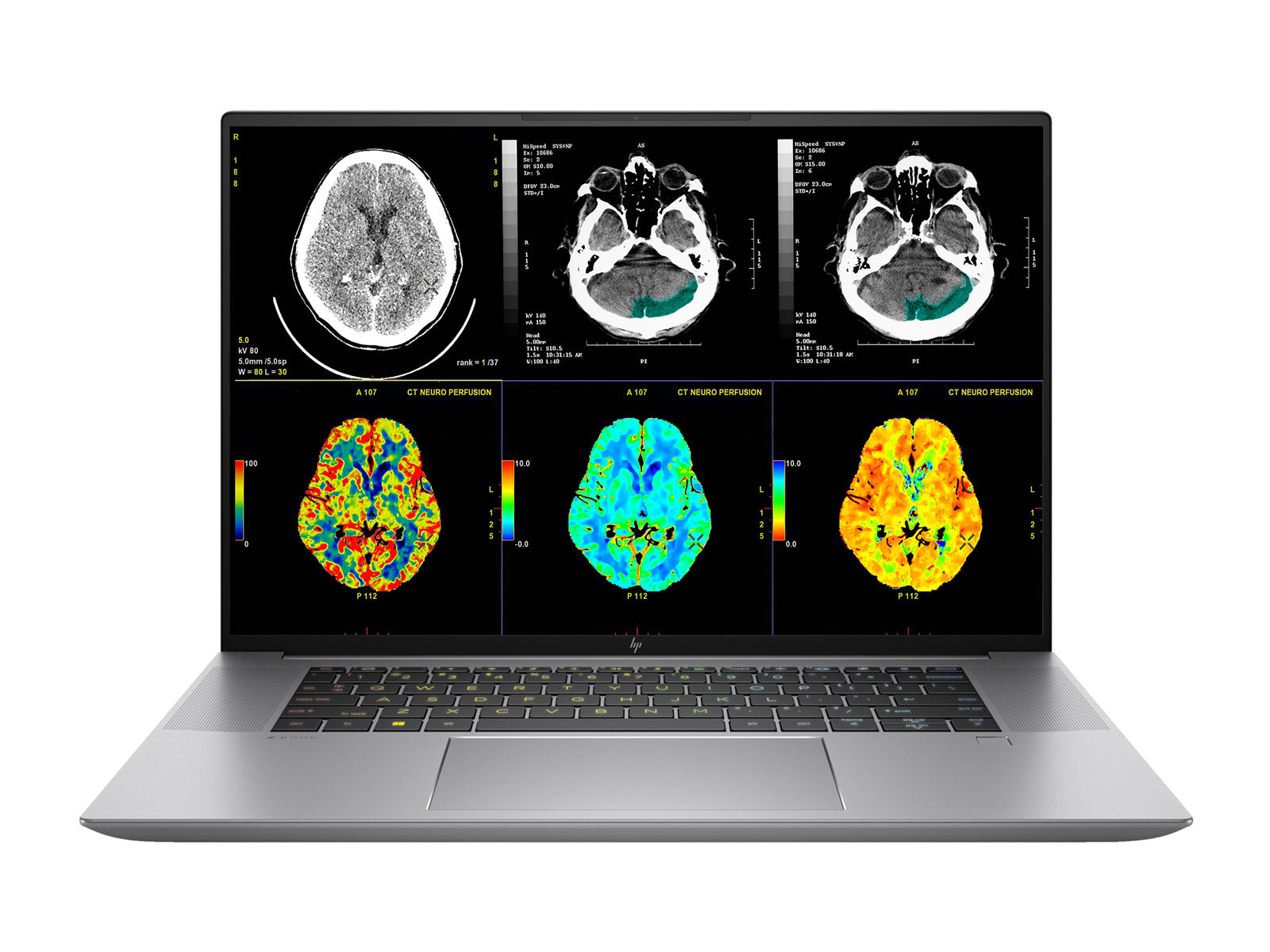 Estação completa de leitura de revisão clínica | 2 x LG 27 "8MP Displays de revisão clínica de cores | HP ZBook Studio 16 G10 | Ditation Mic | Pacote de calibração PerfectLum (LGHP16G10)