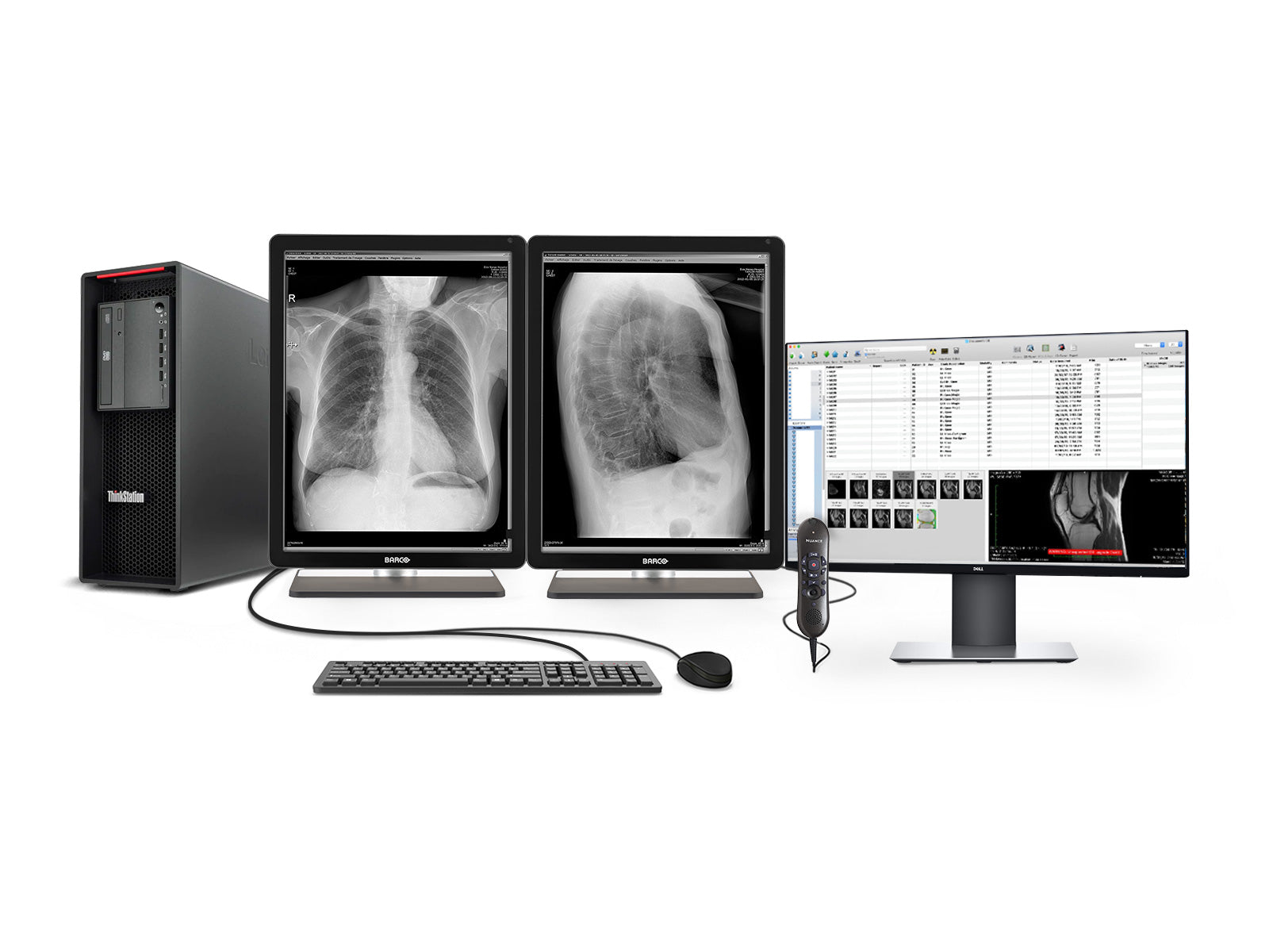 Complete PACS Gen Rad Station | Barco Displays | Lenovo Workstation